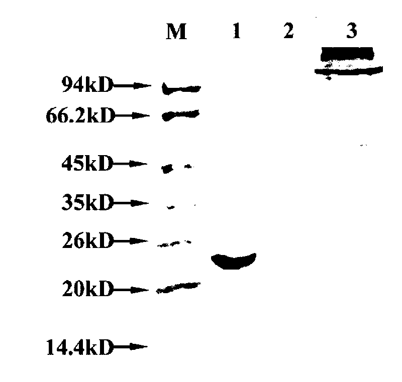 Human epididymal expression sperm binding protein HEL-28 as well as encoding gene and application thereof