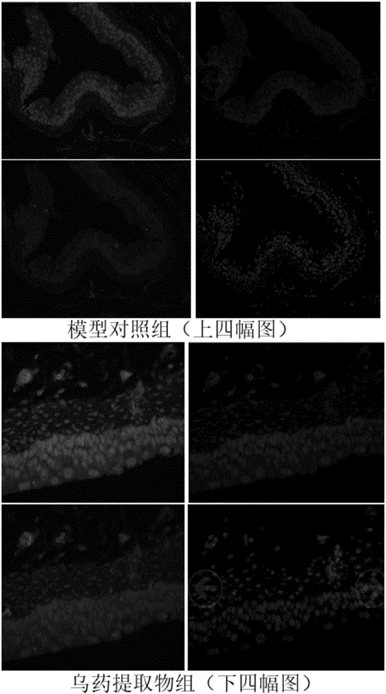 Radix linderae extract for treating diabetic bladder dysfunction disease and preparation method thereof