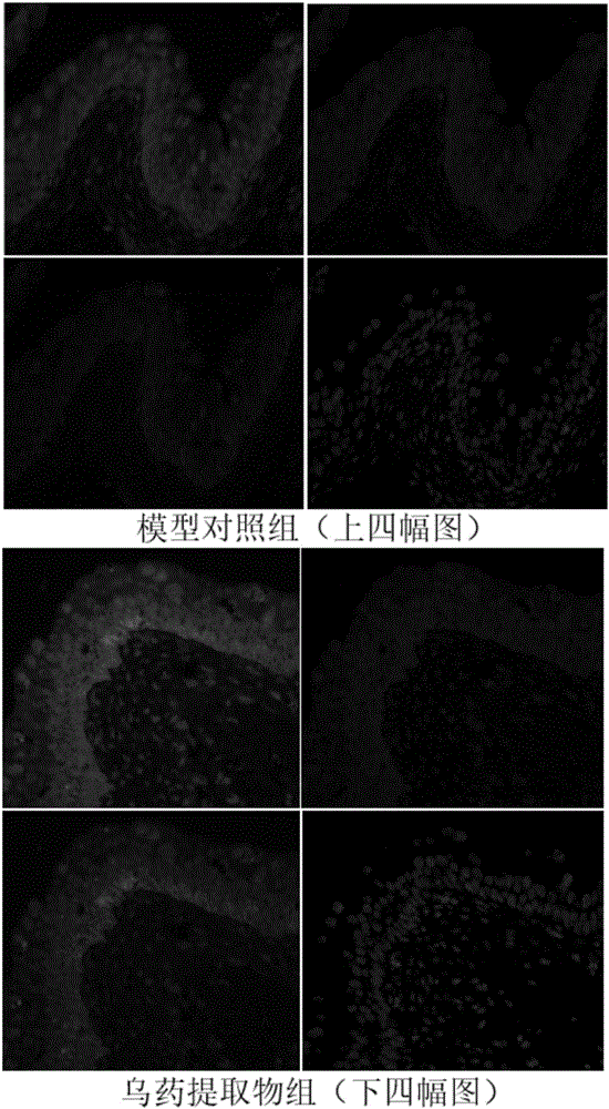Radix linderae extract for treating diabetic bladder dysfunction disease and preparation method thereof