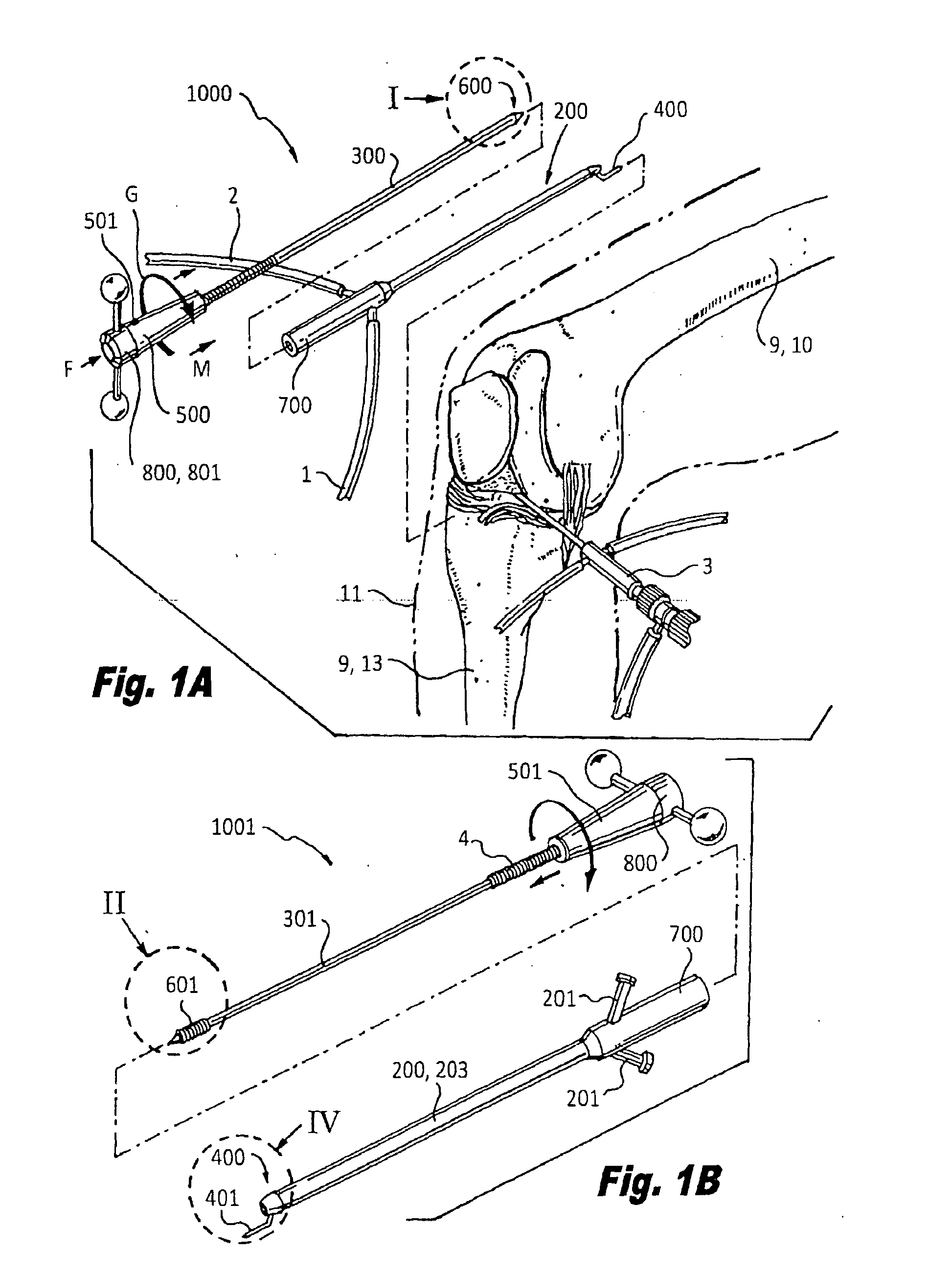 Cannulated apparatus and method relating to microfracture and revascularization methodologies