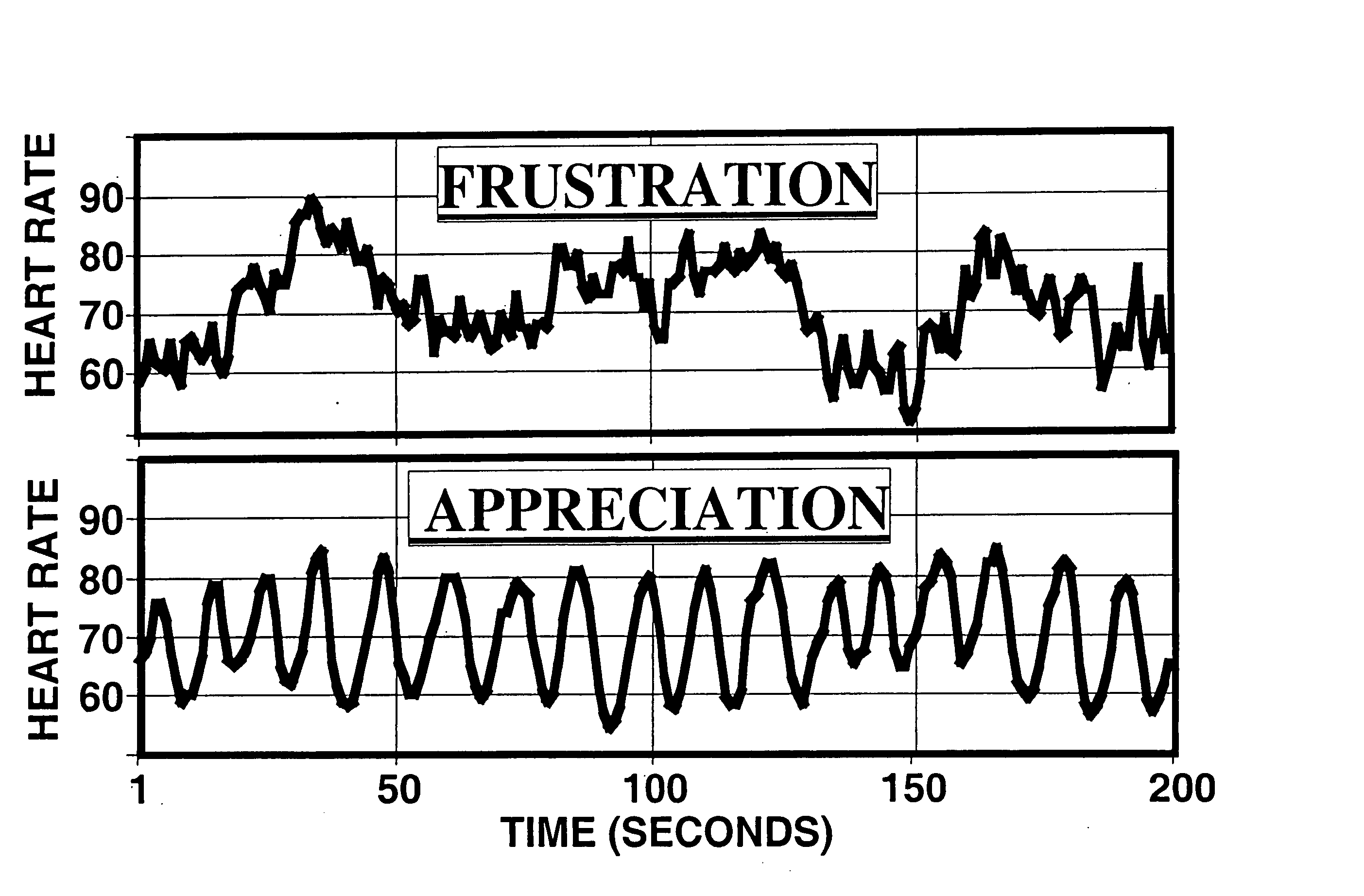 Electrophysiological intuition indicator