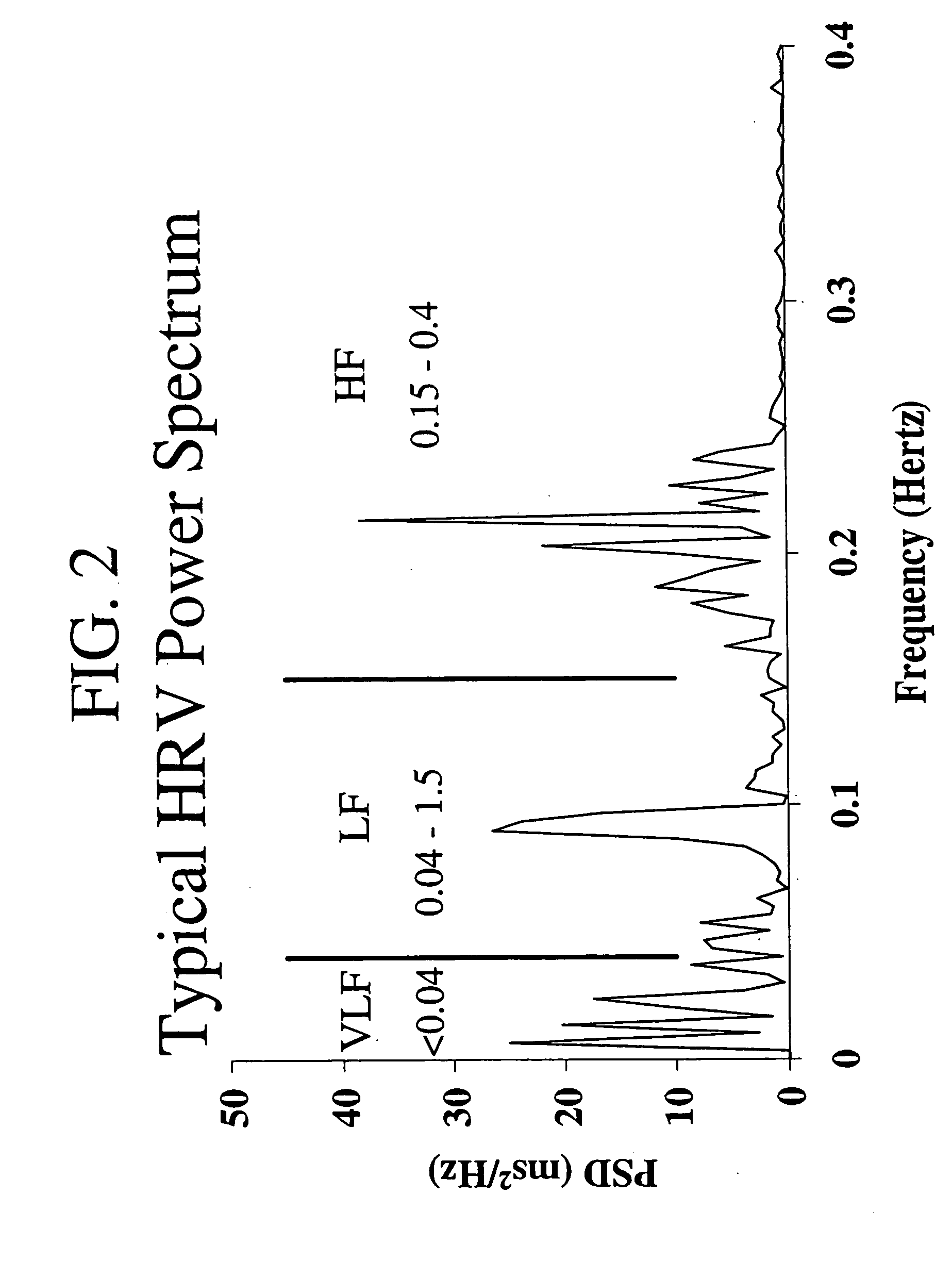 Electrophysiological intuition indicator