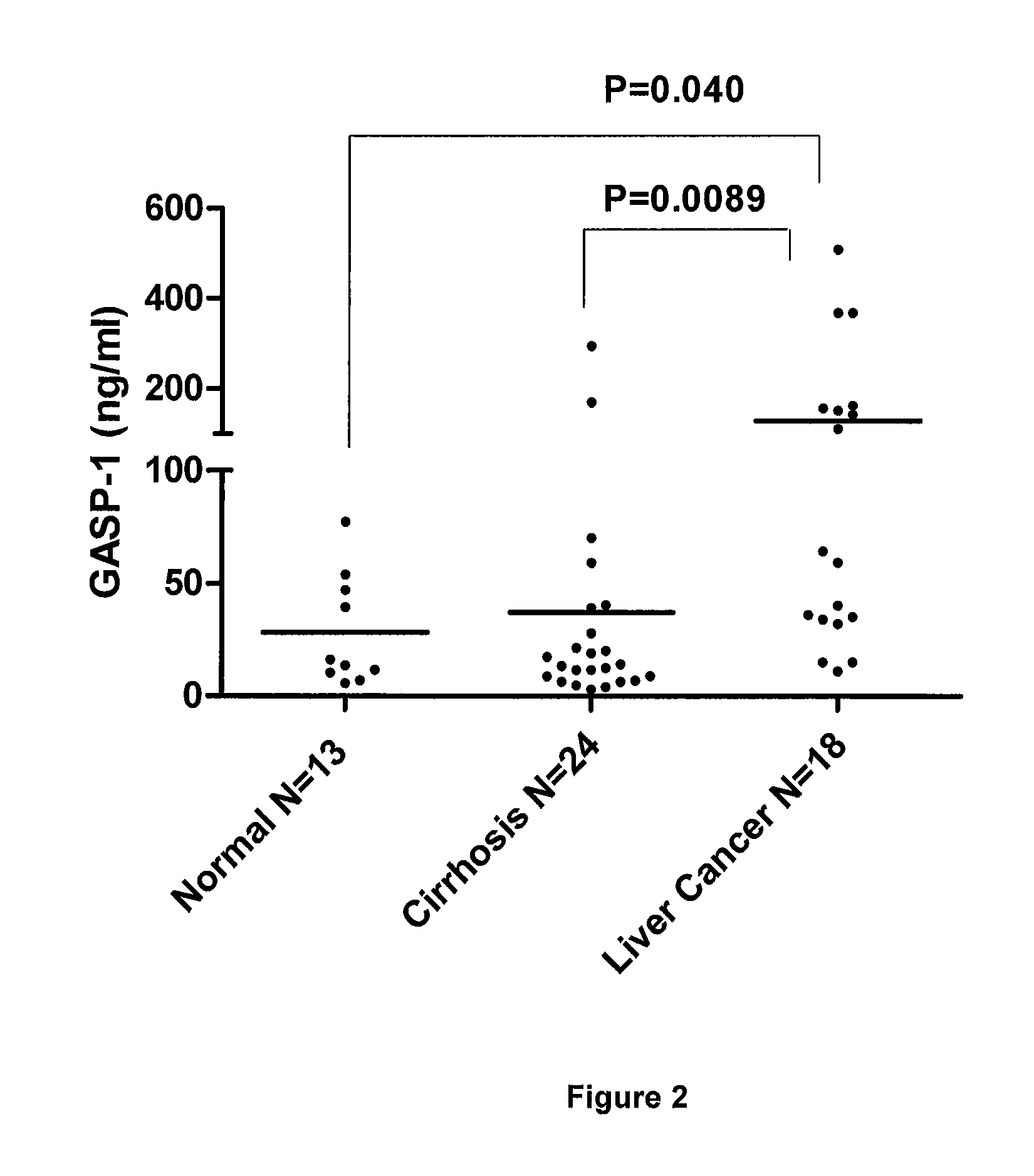 G-protein coupled receptor-associated sorting protein 1 as a cancer biomarker