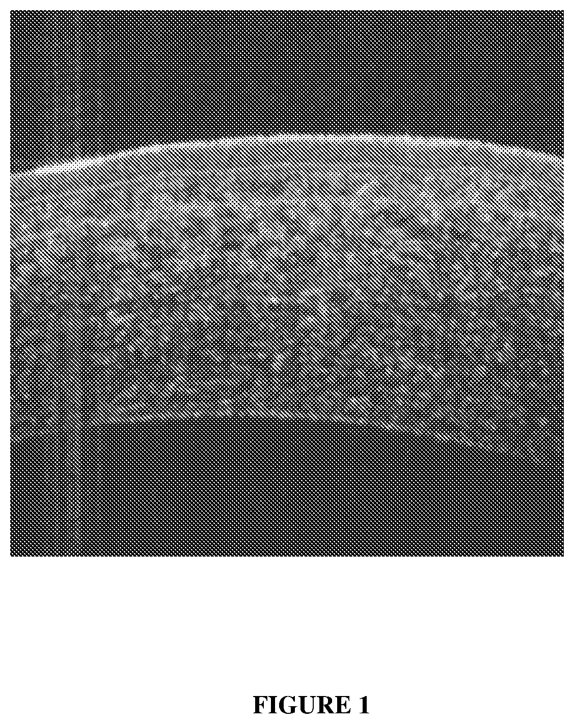 Index for quanitification of bowman's layer roughness for diagnosis of disease and prognosis of treatments in human cornea