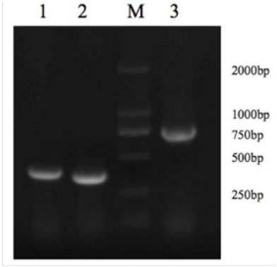 Porcine single-chain antibody for resisting hog cholera viruses and preparation method thereof