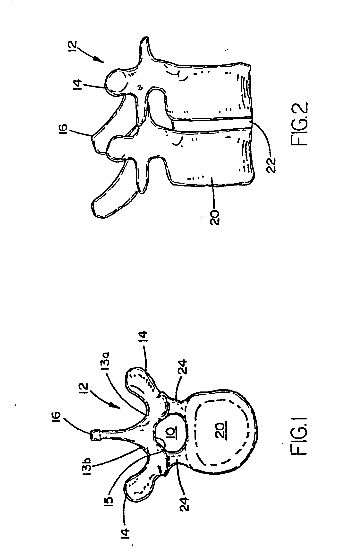 Adjustable tandem connectors for corrective devices for the spinal column and other bones and joints