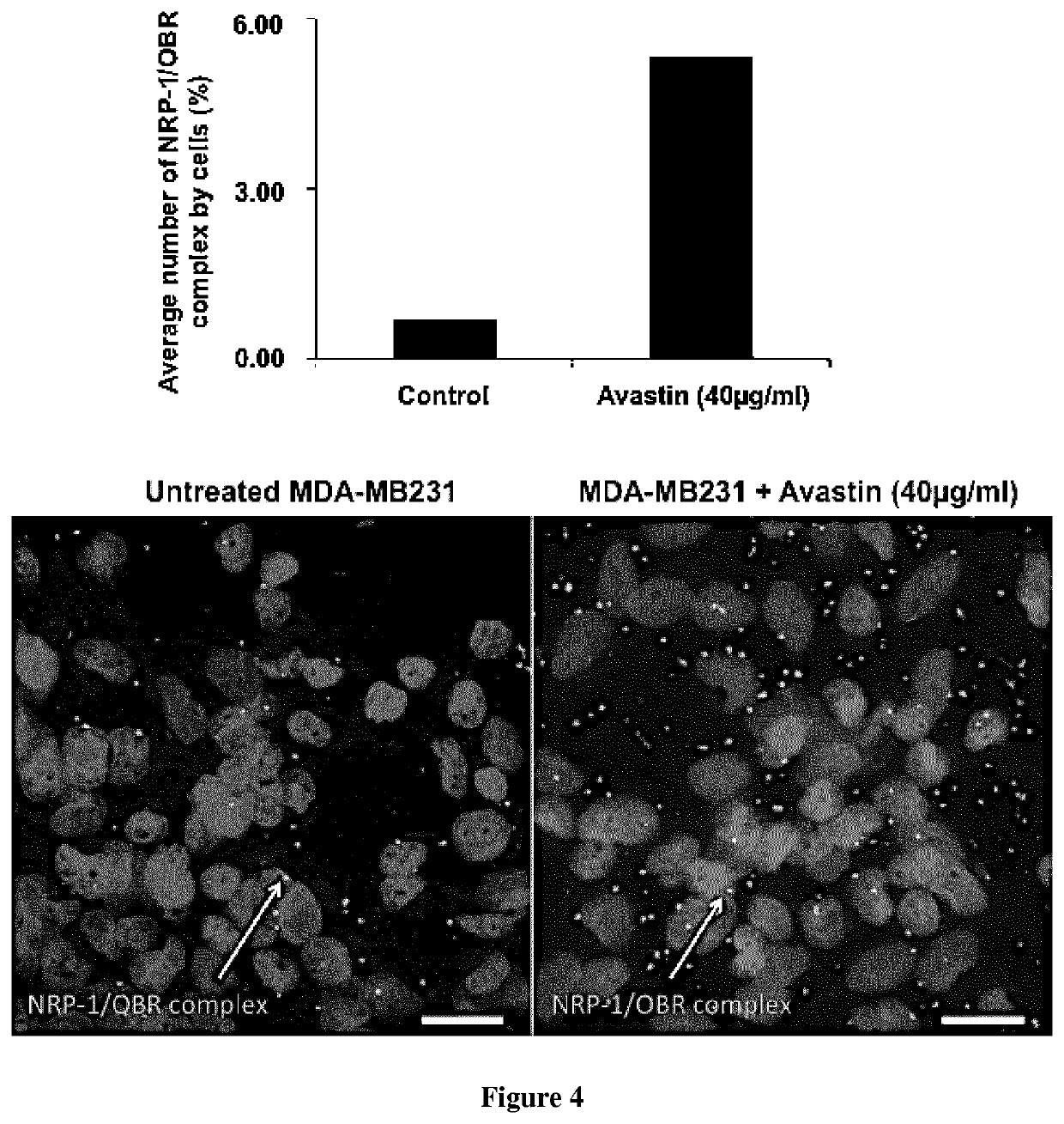 Polypeptides capable of inhibiting the binding between leptin and Neuropilin-1