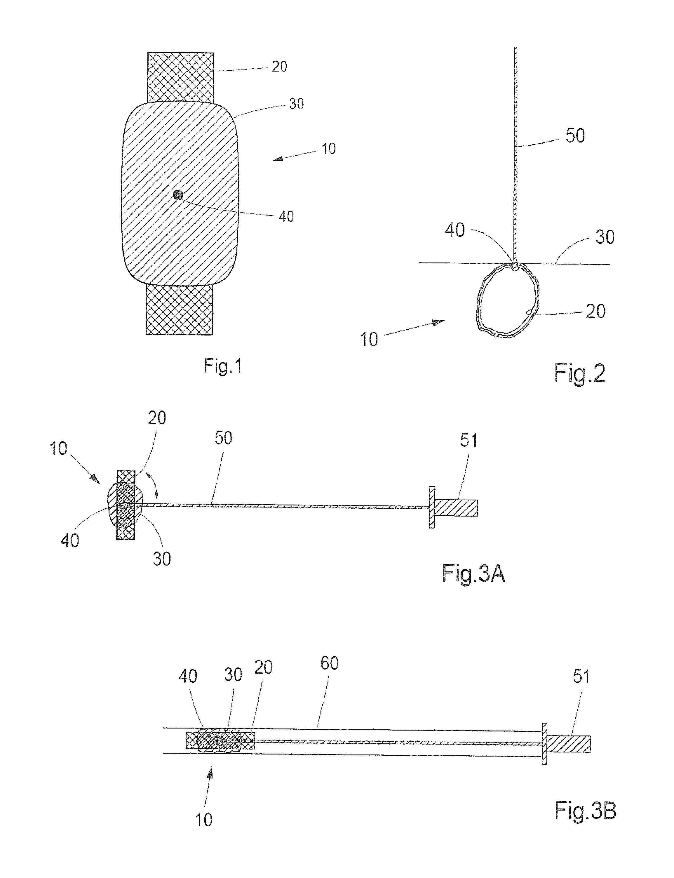 Device And Method For Closure Of A Body Lumen