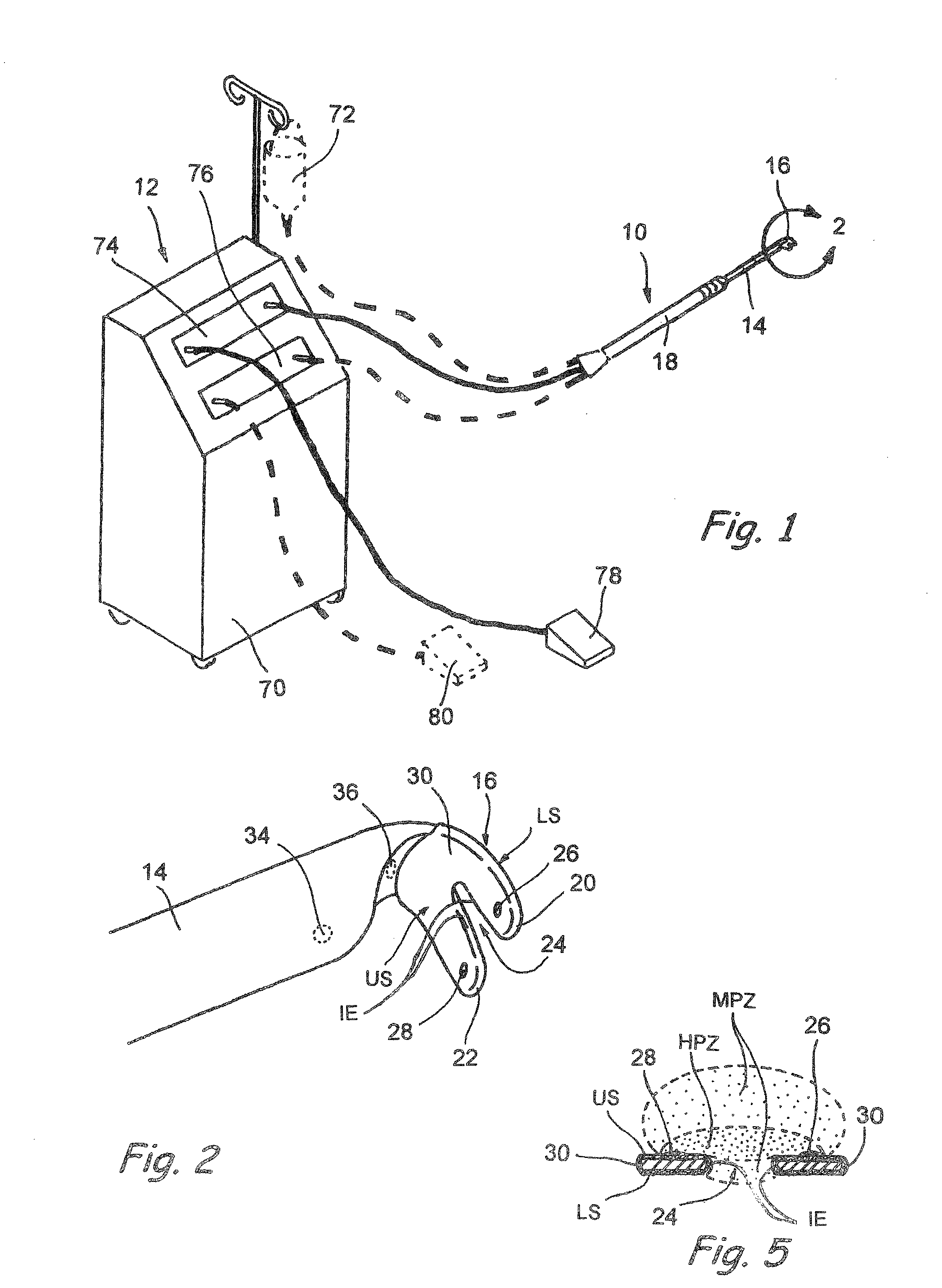 Electrosurgical devices and methods for selective cutting of tissue