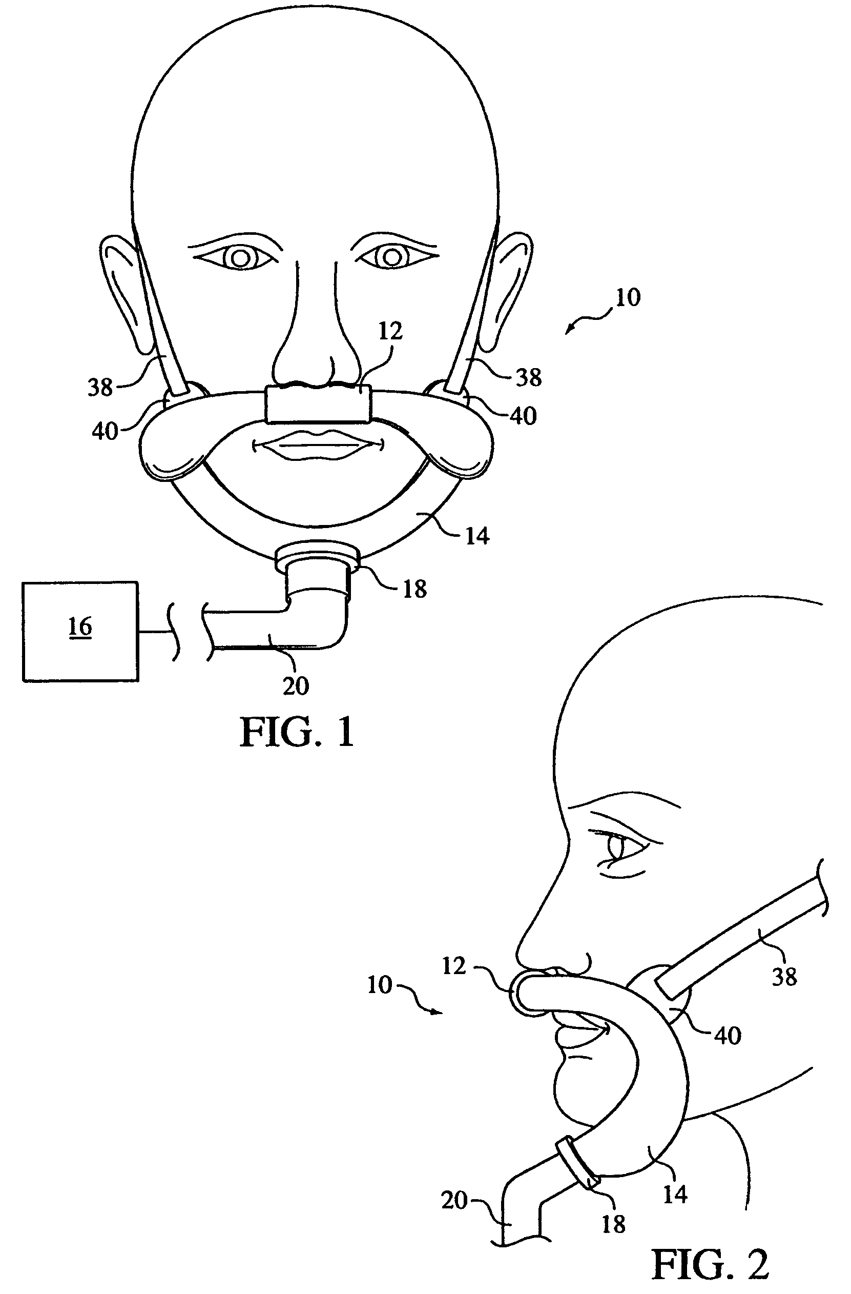 Patient interface assembly supported under the mandible