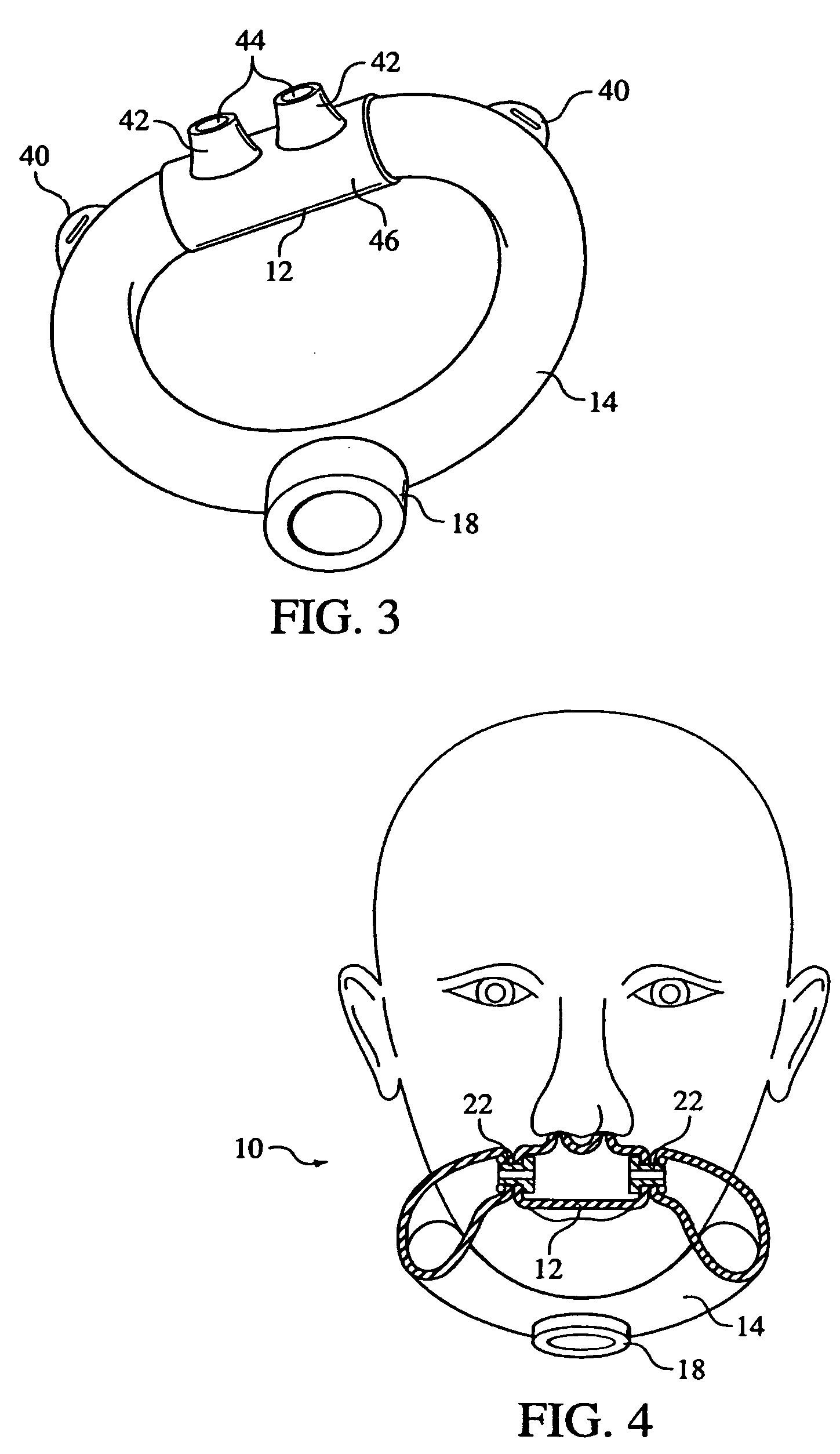 Patient interface assembly supported under the mandible