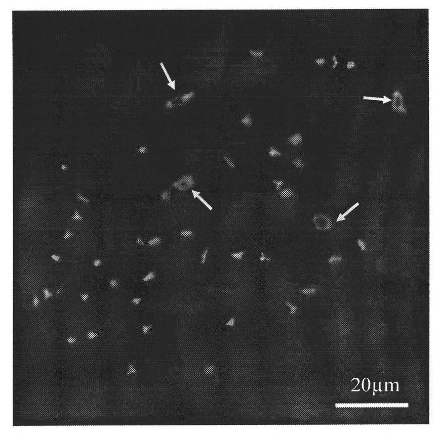 Method for preparing fish ovary germ cell chromosome