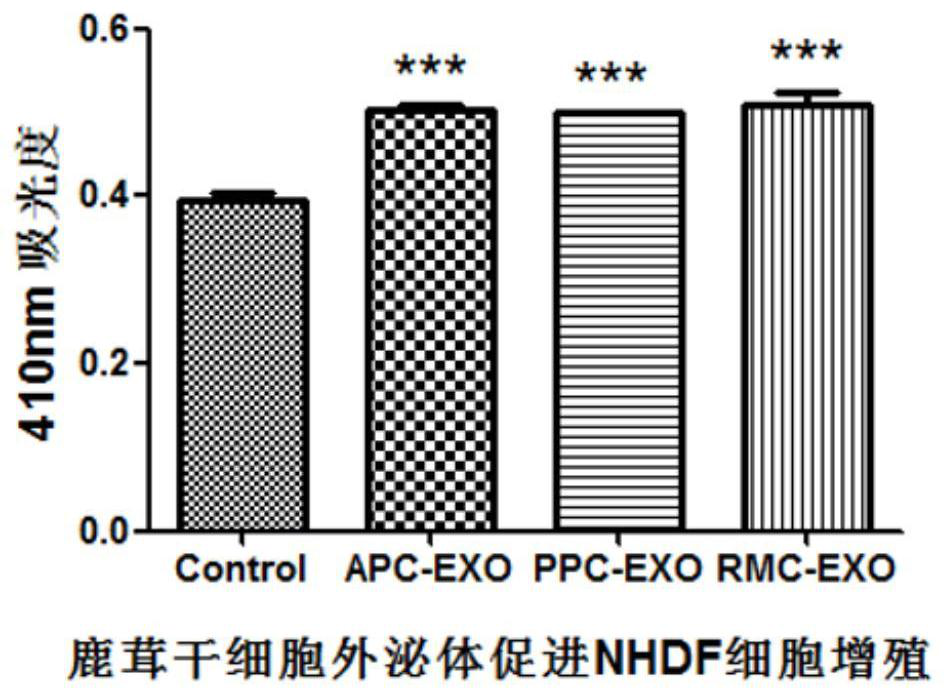 Preparation method and application of pilose antler stem cell exosome for resisting skin aging