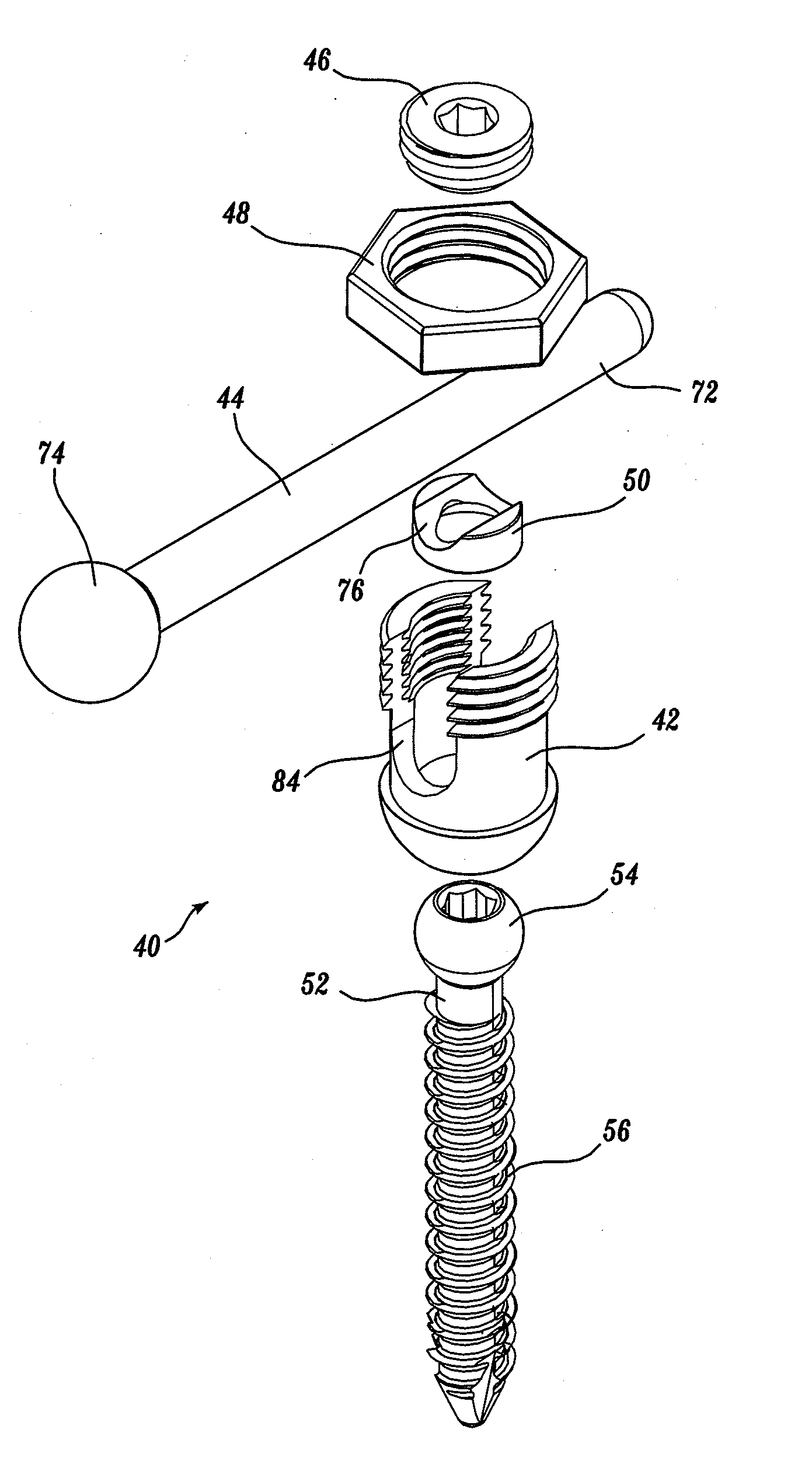 Polyaxial adjustment of facet joint prostheses