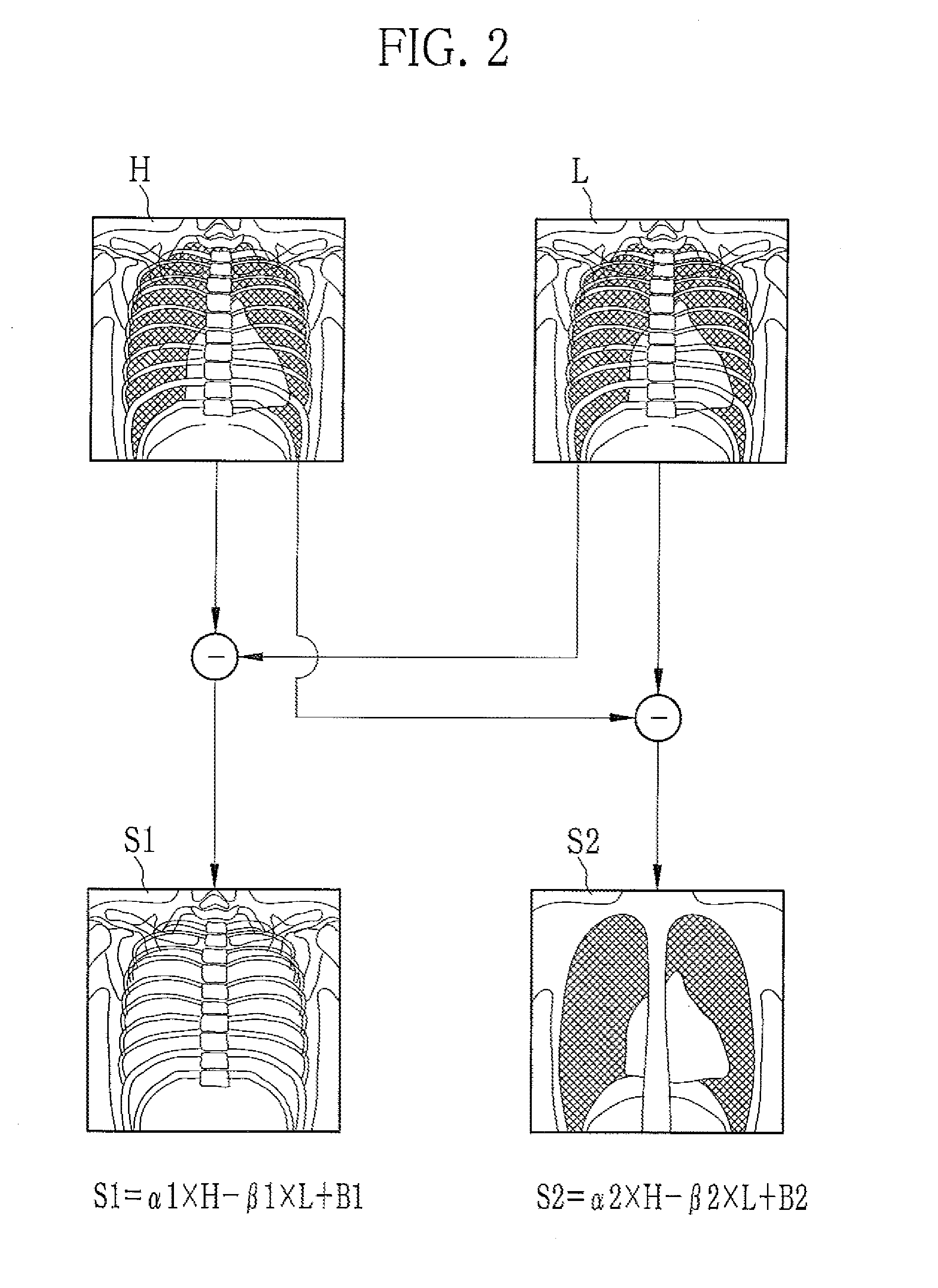 Radiation imaging apparatus and imaging control device