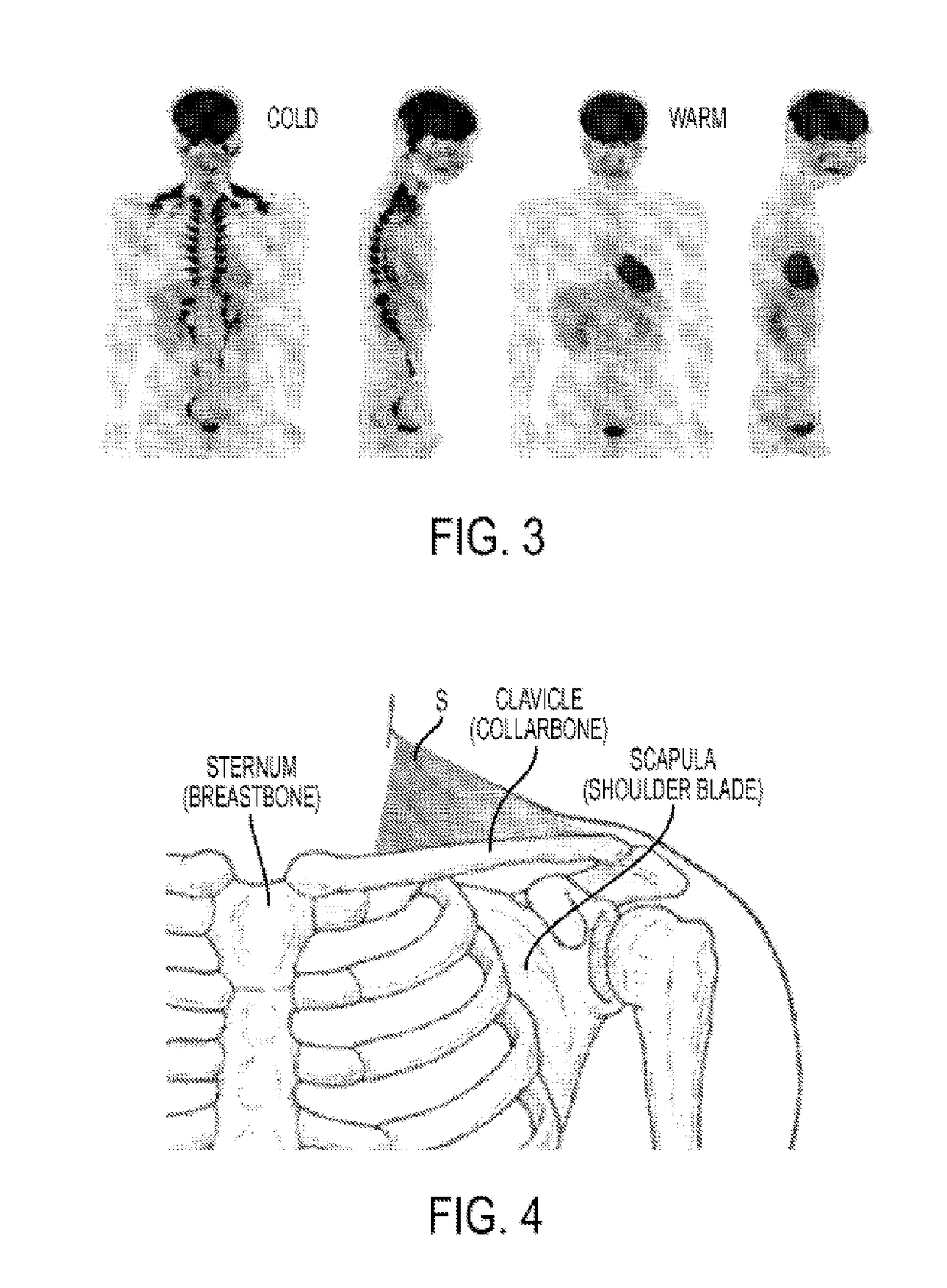 Methods and devices for activating brown adipose tissue with targeted substance delivery