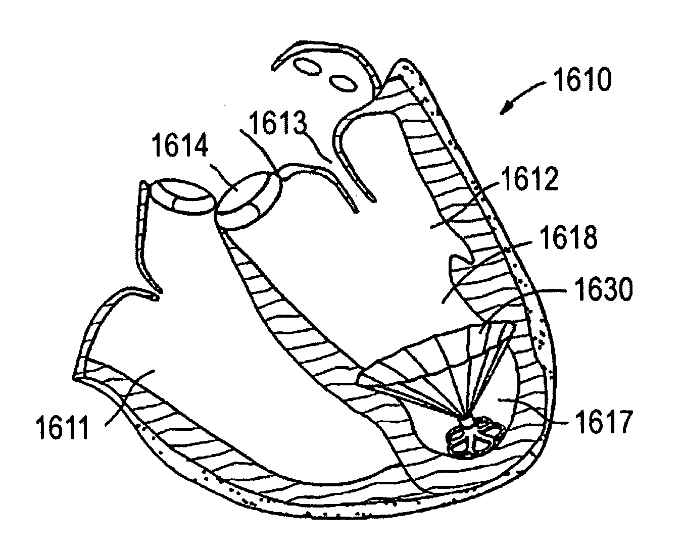 Cardiac device and methods of use thereof