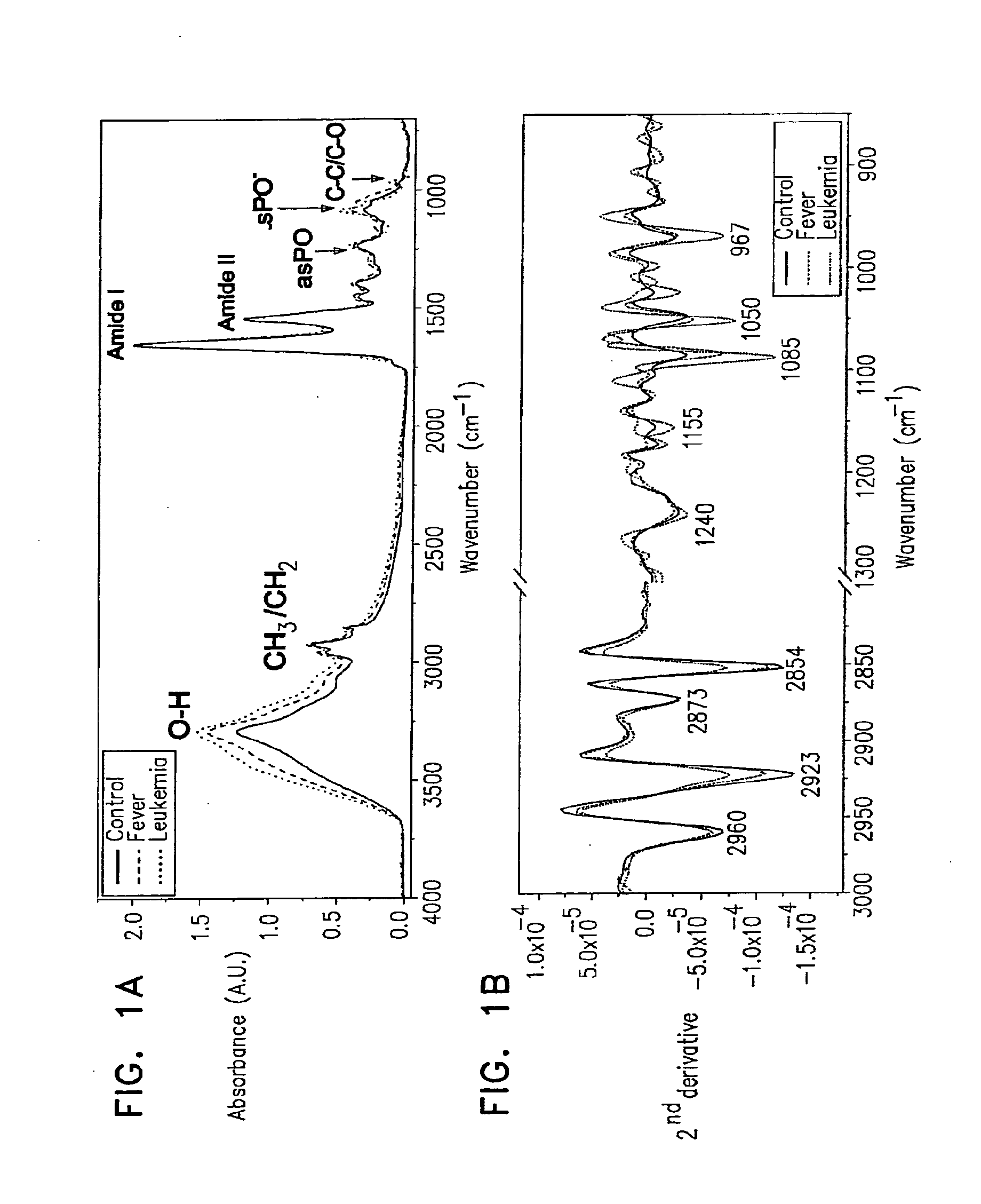 Method and system for detecting and monitoring hematological cancer