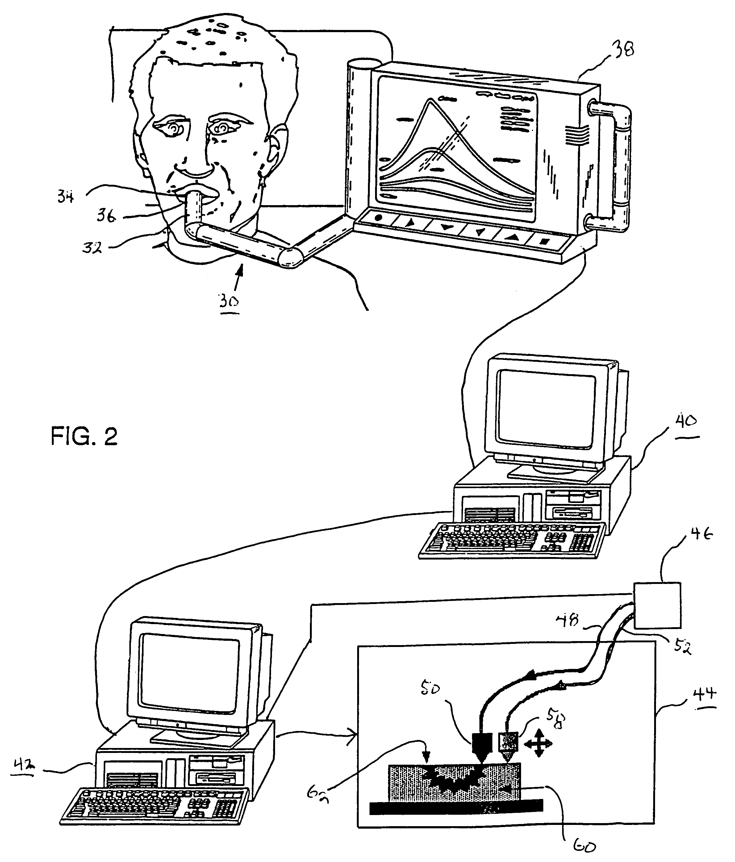 Method for automatically creating a denture using laser altimetry to create a digital 3-D oral cavity model and using a digital internet connection to a rapid stereolithographic modeling machine