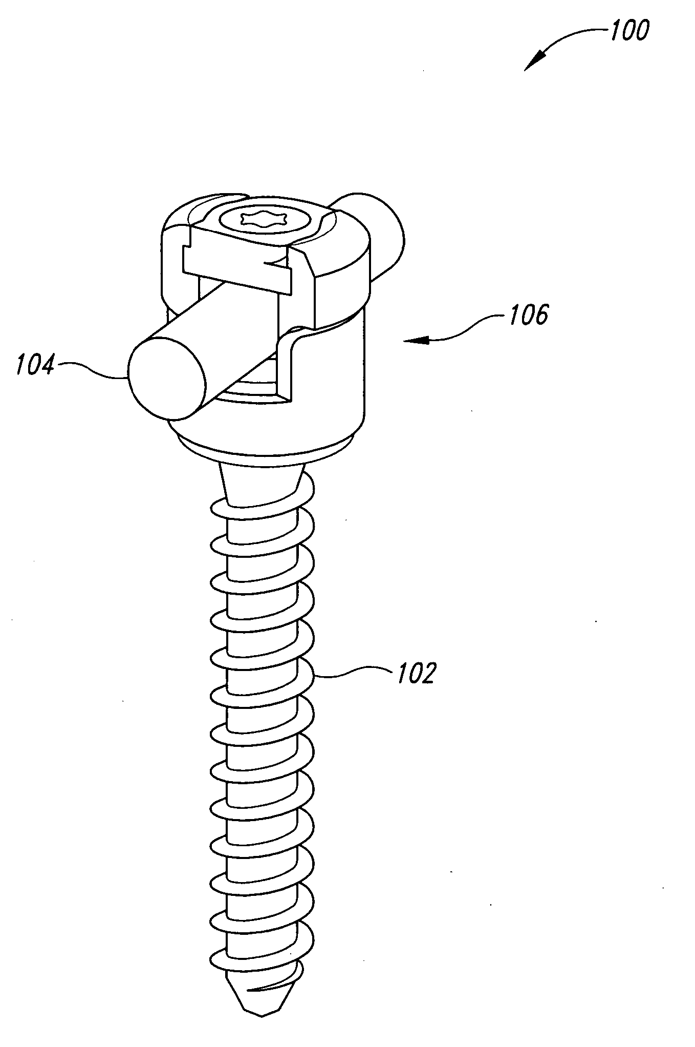 Bone fixation systems and methods of assembling and/or installing the same