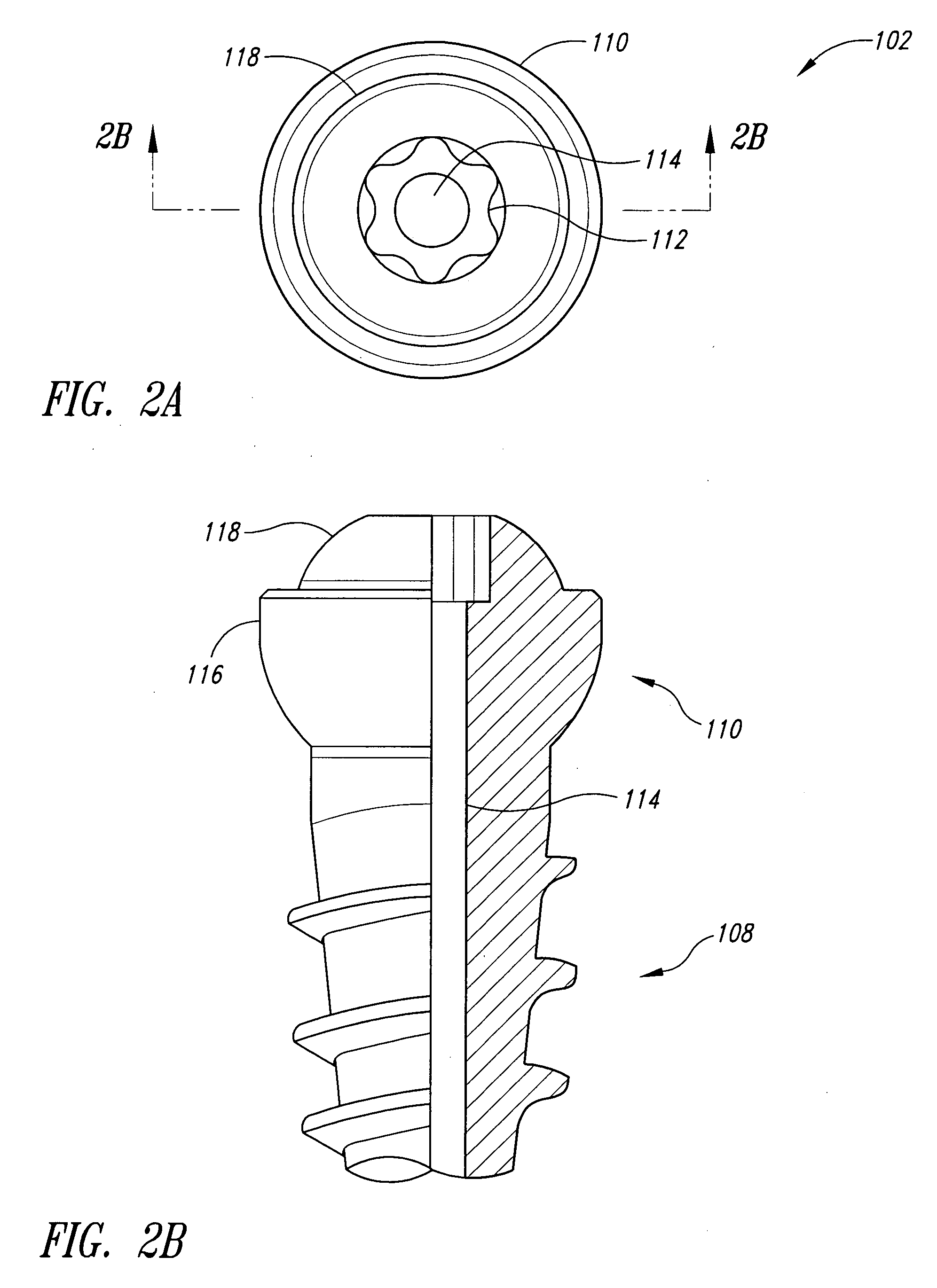 Bone fixation systems and methods of assembling and/or installing the same