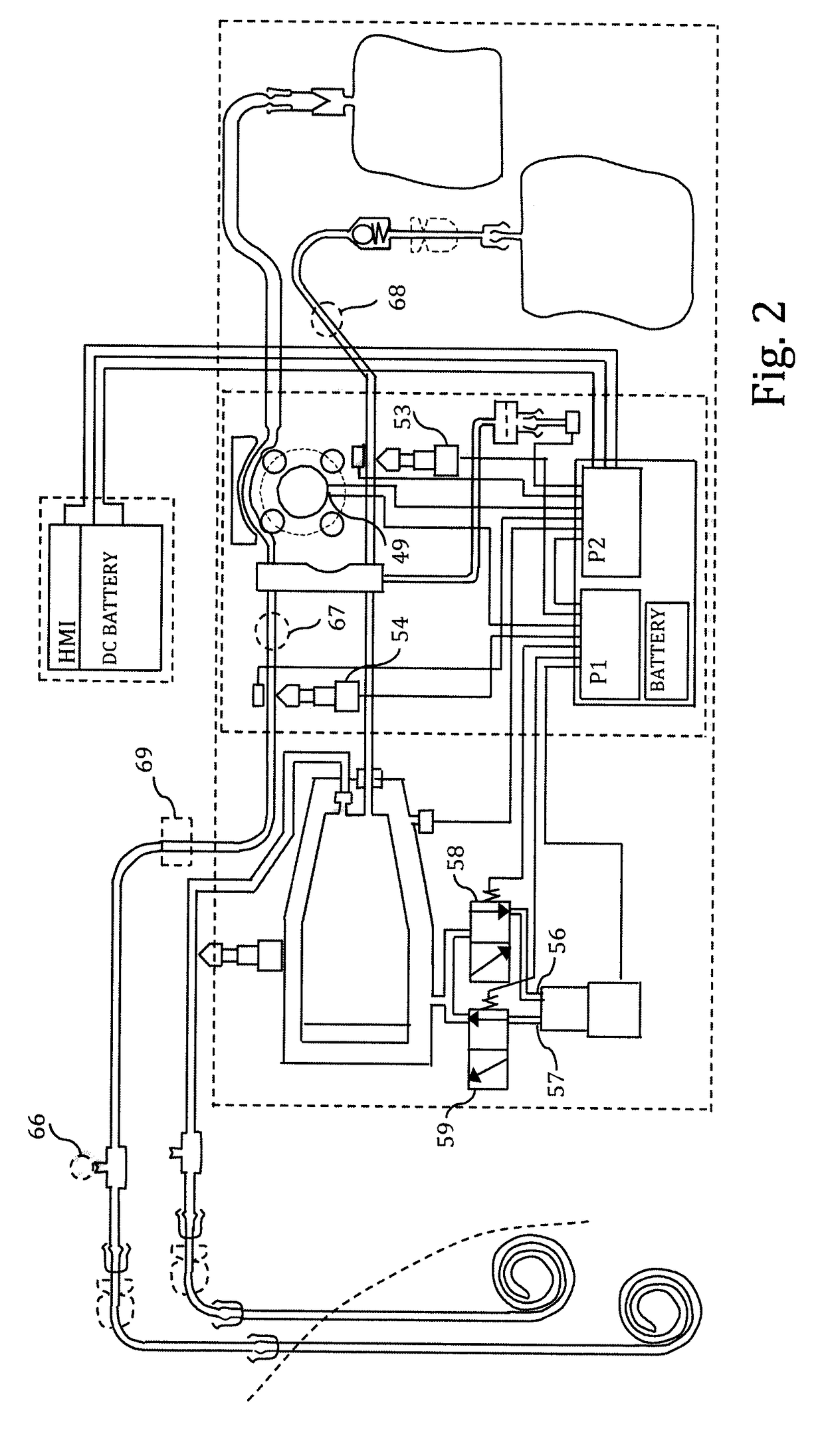 Apparatus for performing peritoneal ultrafiltration