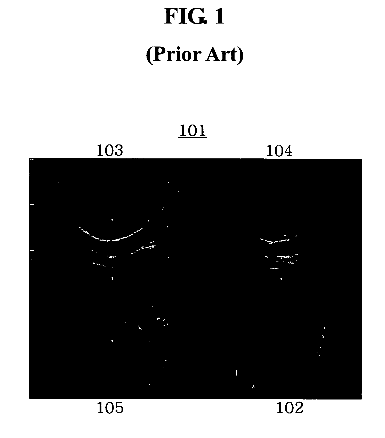 Apparatus and method for enhancing quality of sectional plane image in 3 dimensional ultrasound data