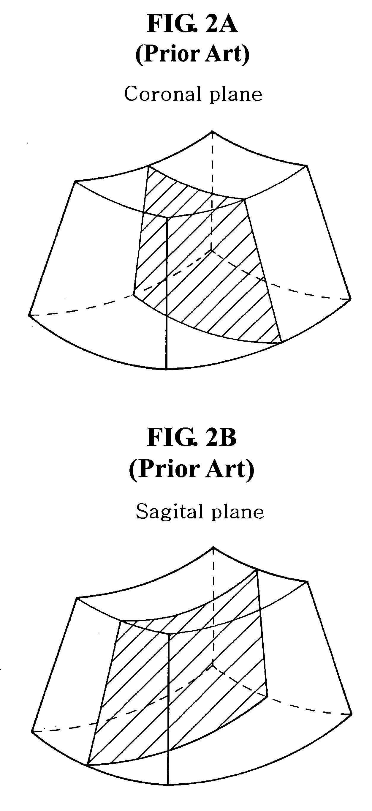 Apparatus and method for enhancing quality of sectional plane image in 3 dimensional ultrasound data