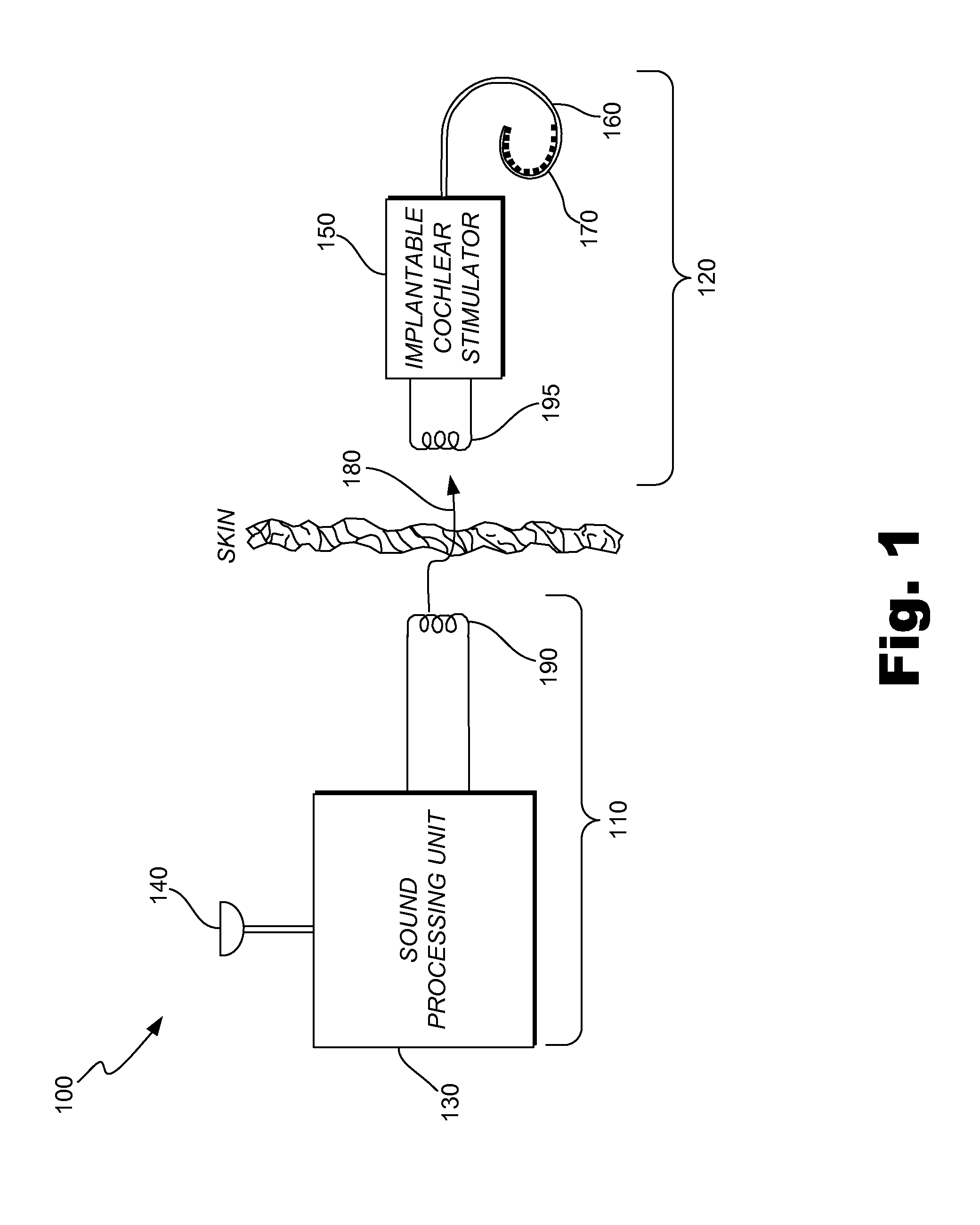 Channel-Specific Adjustment of Sound Processing Strategies Based on Electrode Impedance
