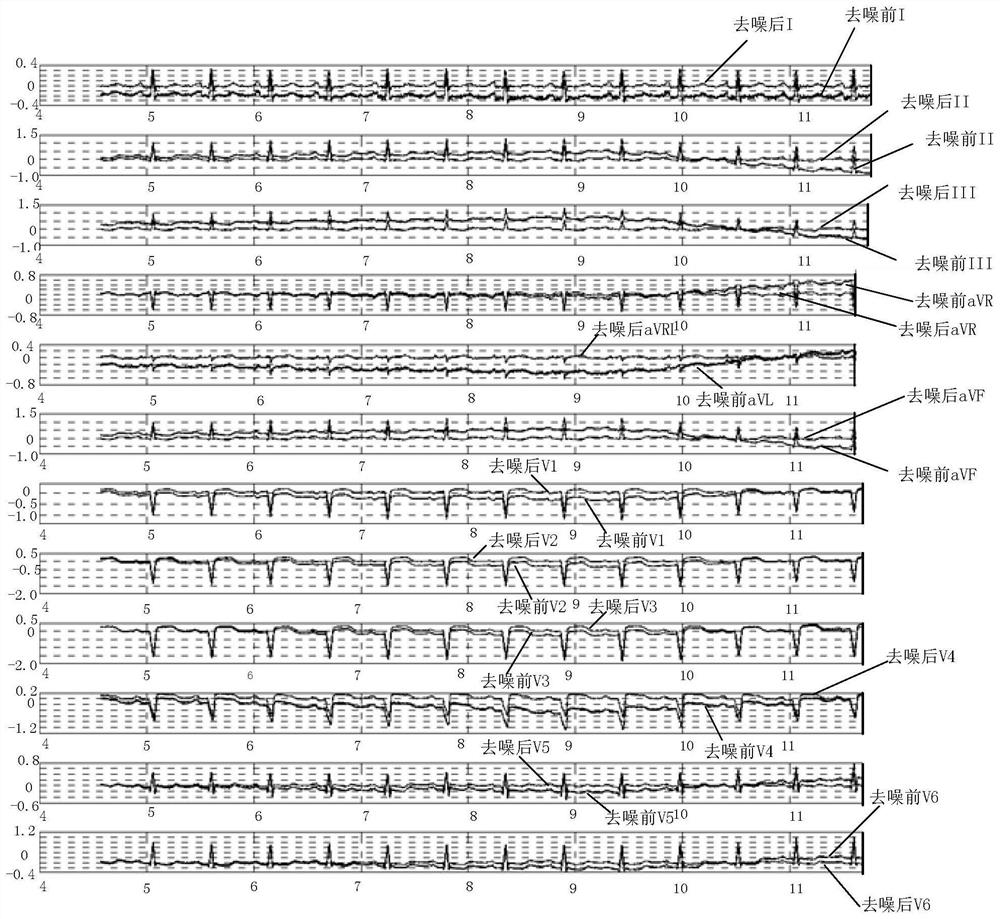 Analysis method, device, storage medium and processor of electrocardiographic signal