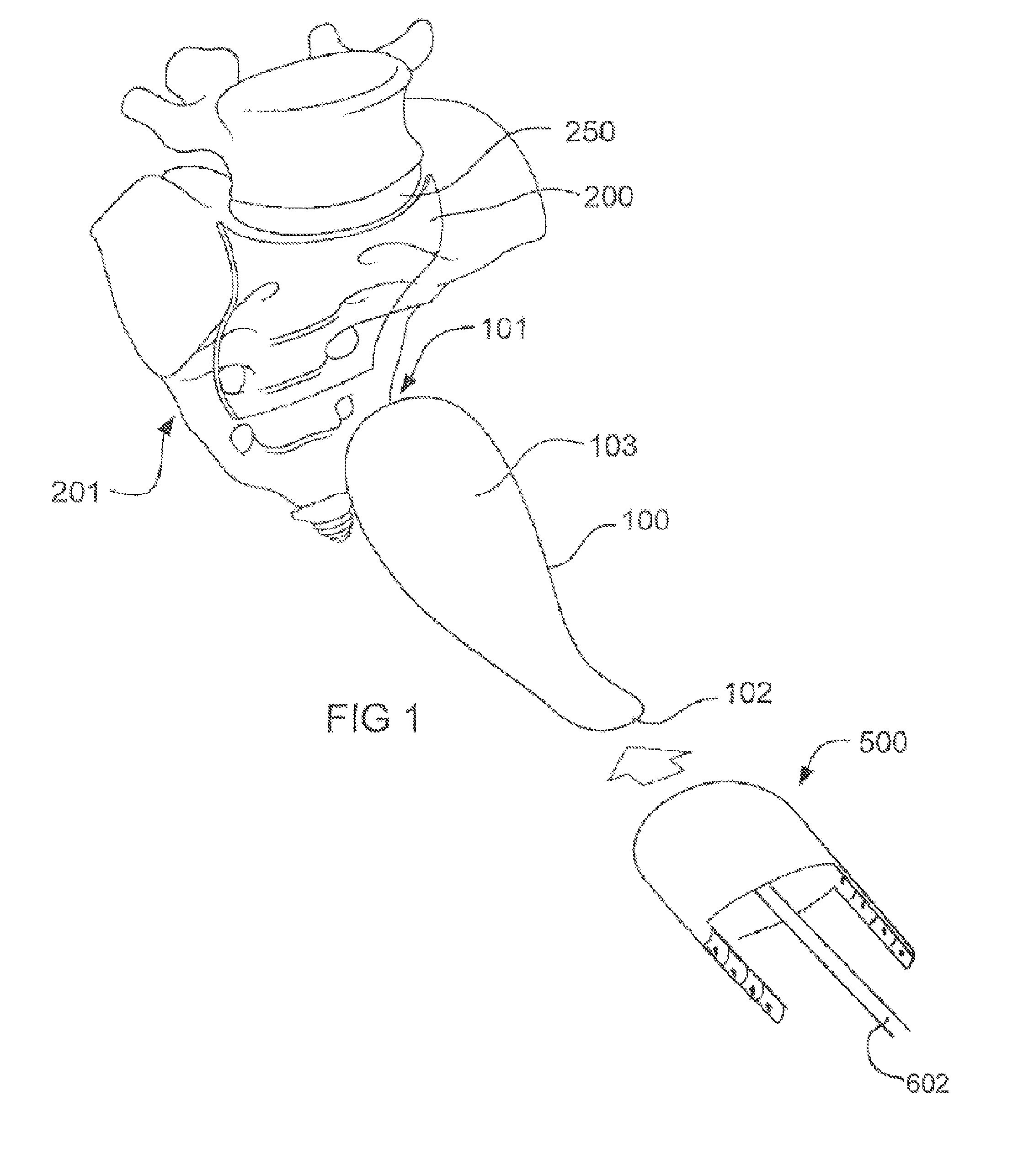Methods and devices for repair of vaginal wall or uterus