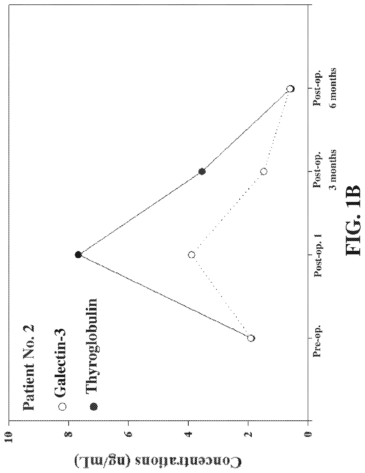 Biomarker for prognosis of thyroid cancer