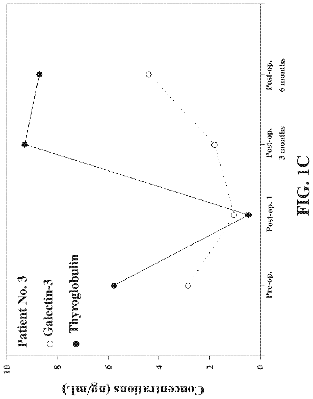 Biomarker for prognosis of thyroid cancer