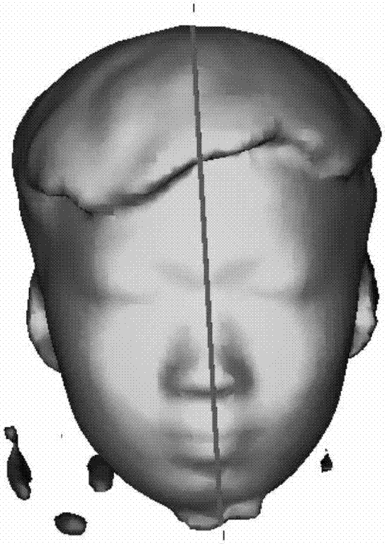 Symmetry analysis method for three-dimensional face model