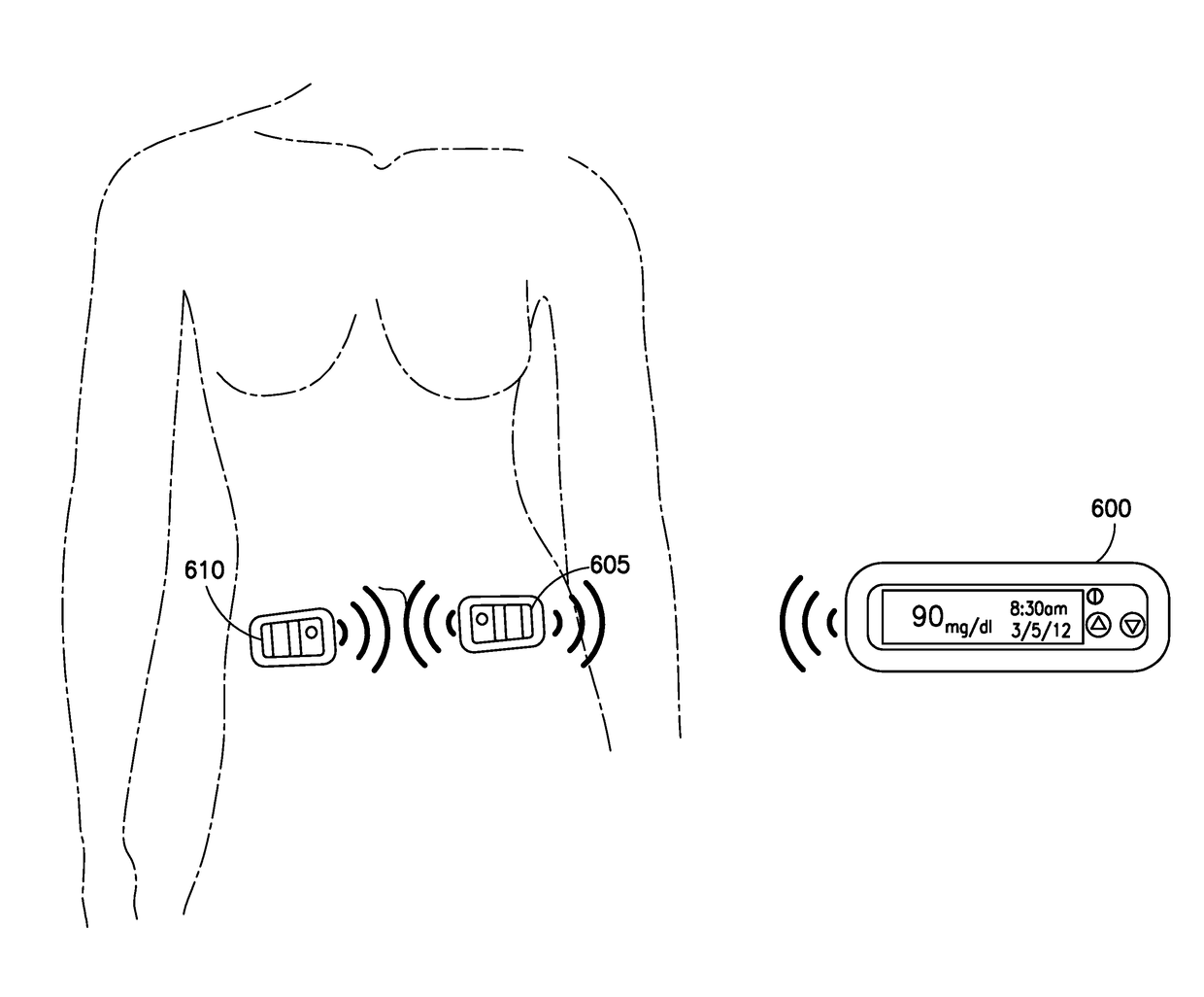 Wireless Communication for On-Body Medical Devices