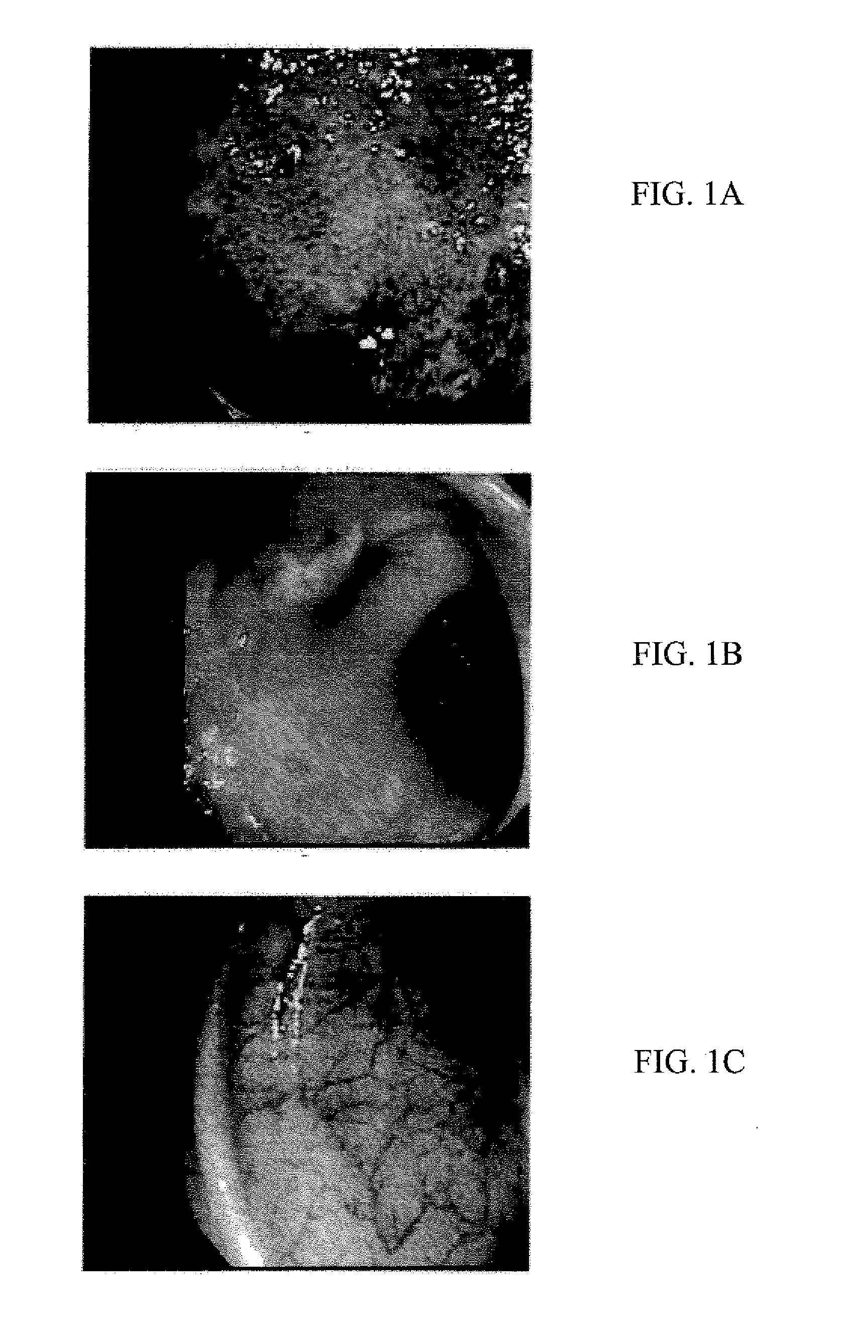 Materials and methods for treatment and diagnosis of disorders associated with oxidative stress