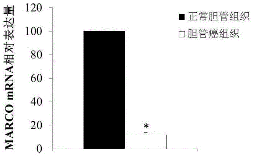 Bile duct cancer diagnosis and treatment molecular marker and application thereof