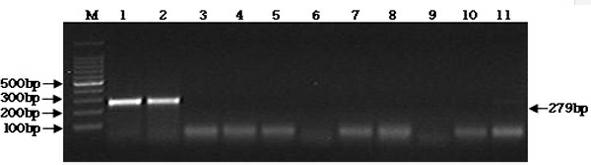 Immunocapture PCR (polymerase chain reaction) detection kit of staphylococcus aureus and using method of kit