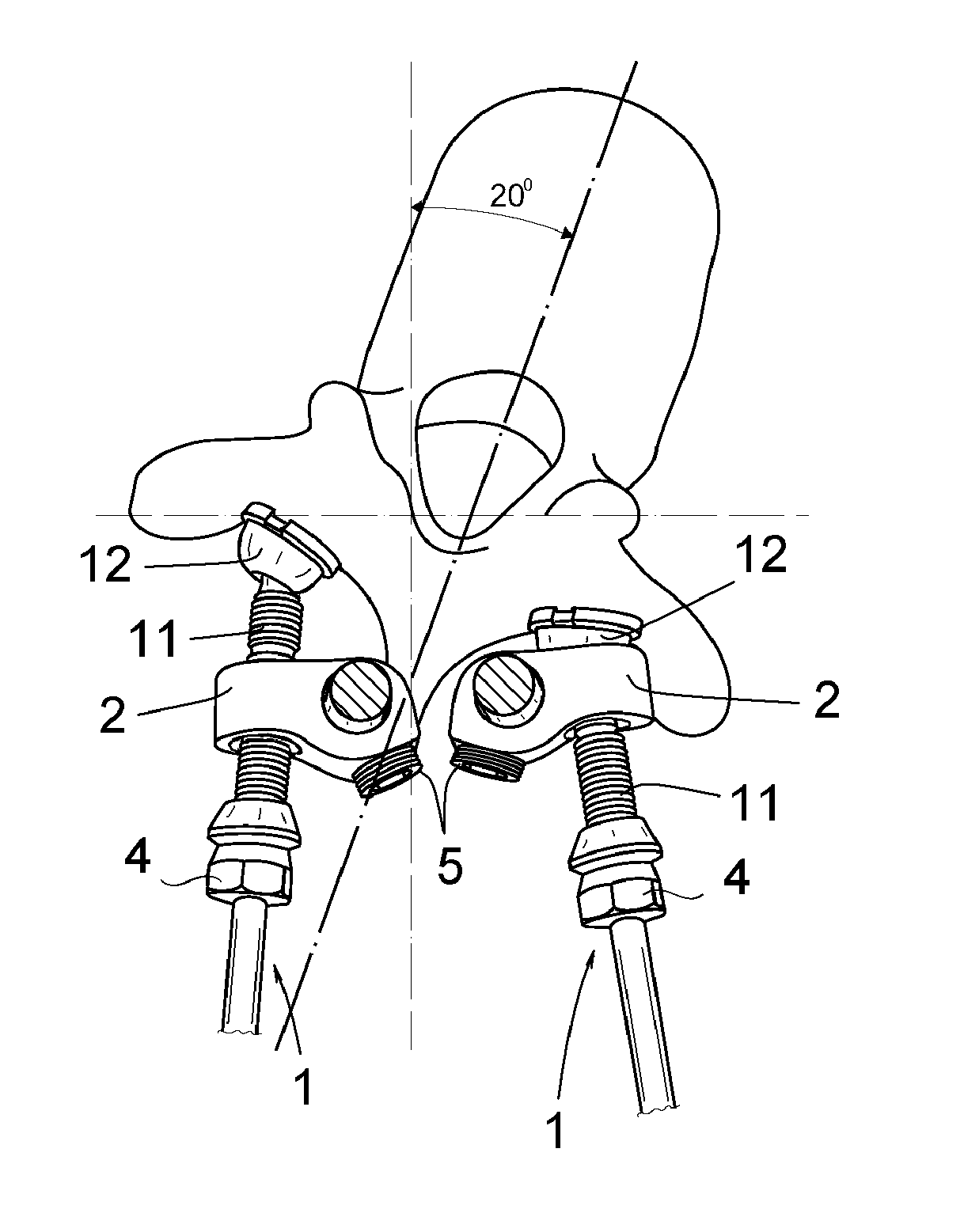 Method for rotating a vertebra or vertebrae