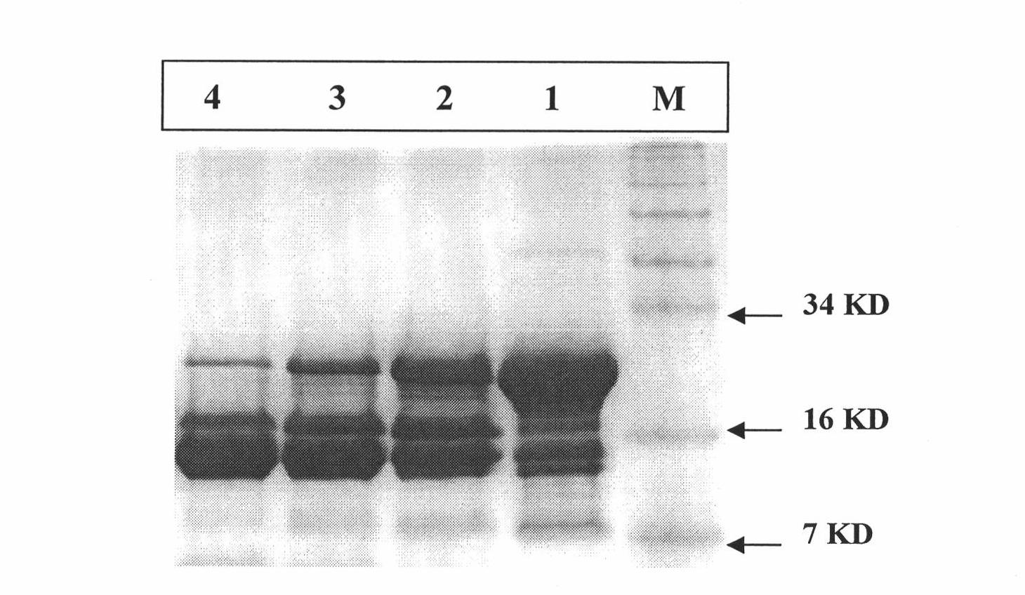 Synthetic method of enterokinase light chain gene and preparation method of expression product of enterokinase light chain gene