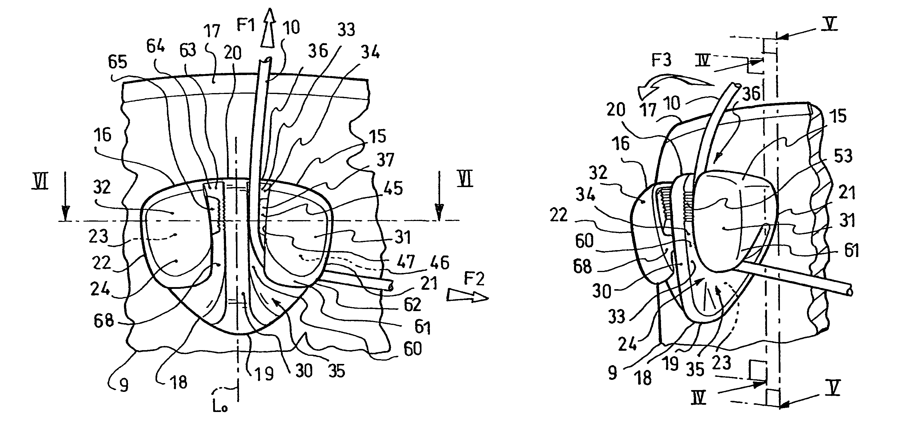 Device for blocking flexible strands
