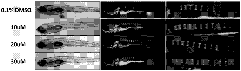 A Screening System for Drugs Affecting Bone Mineralization