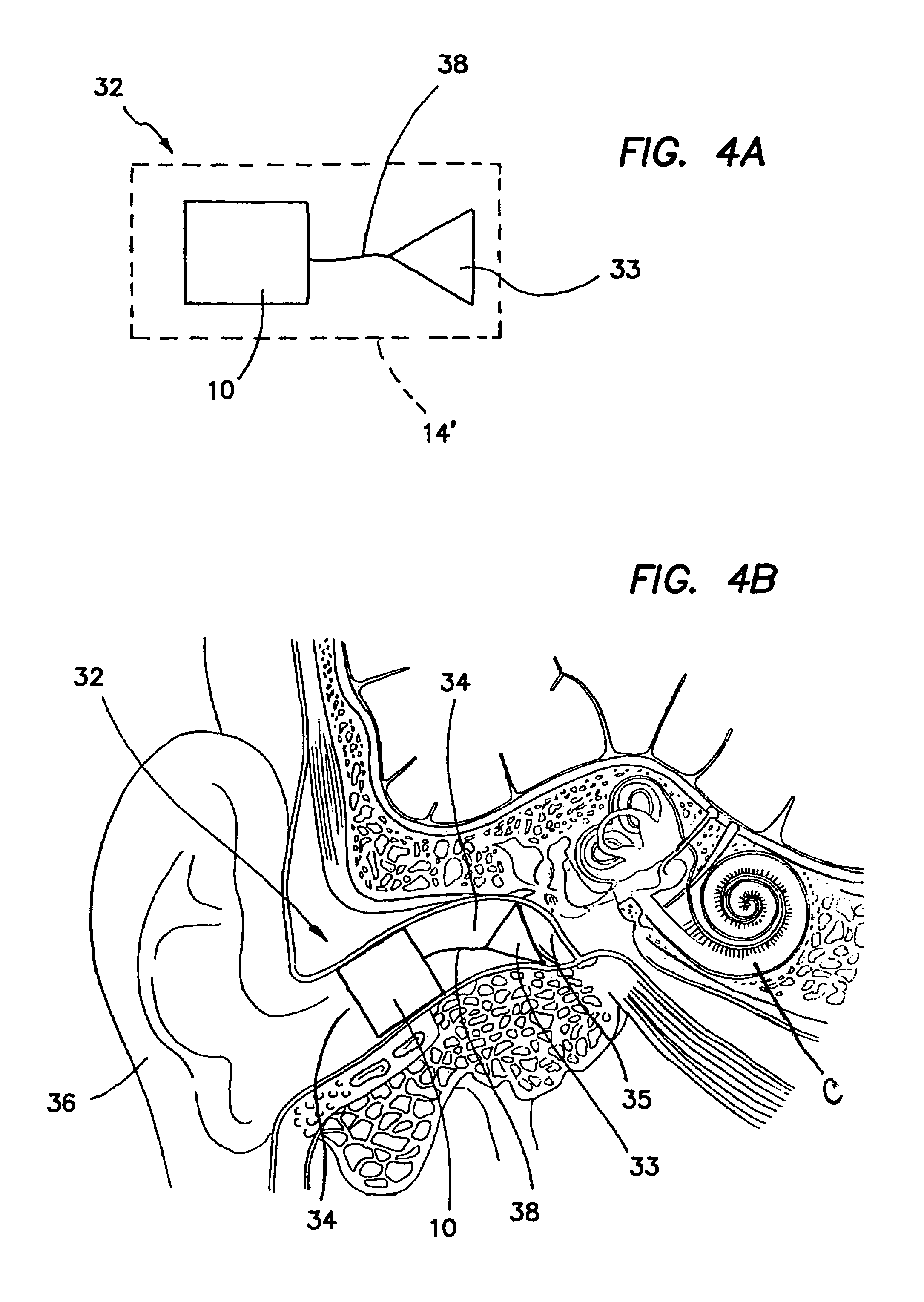 Optical waveguide vibration sensor for use in hearing aid