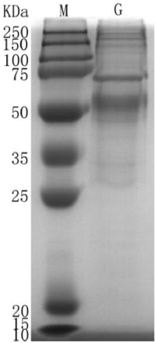Complete humanized monoclonal antibody for RSV attachment G protein surface antigen