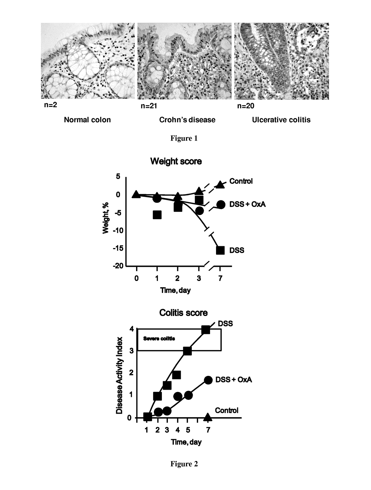 Method of treating an inflammatory bowel disease comprising agonists of orexin-1 receptor