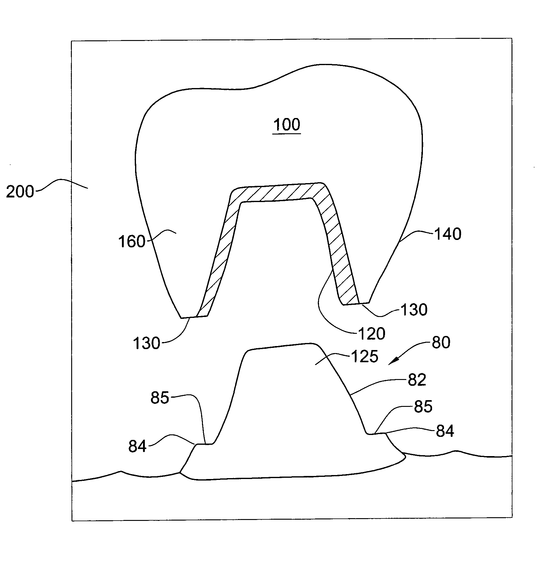 Method and system for providing feedback data useful in prosthodontic procedures associated with the intra oral cavity