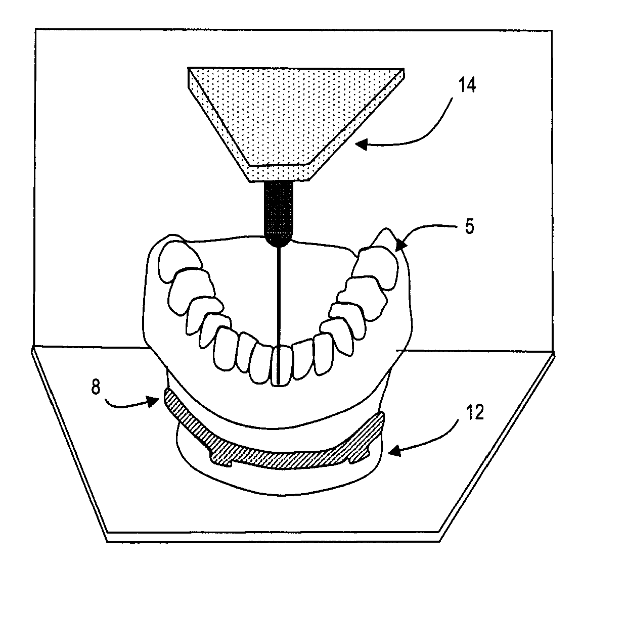 Methods for the virtual design and computer manufacture of intra oral devices
