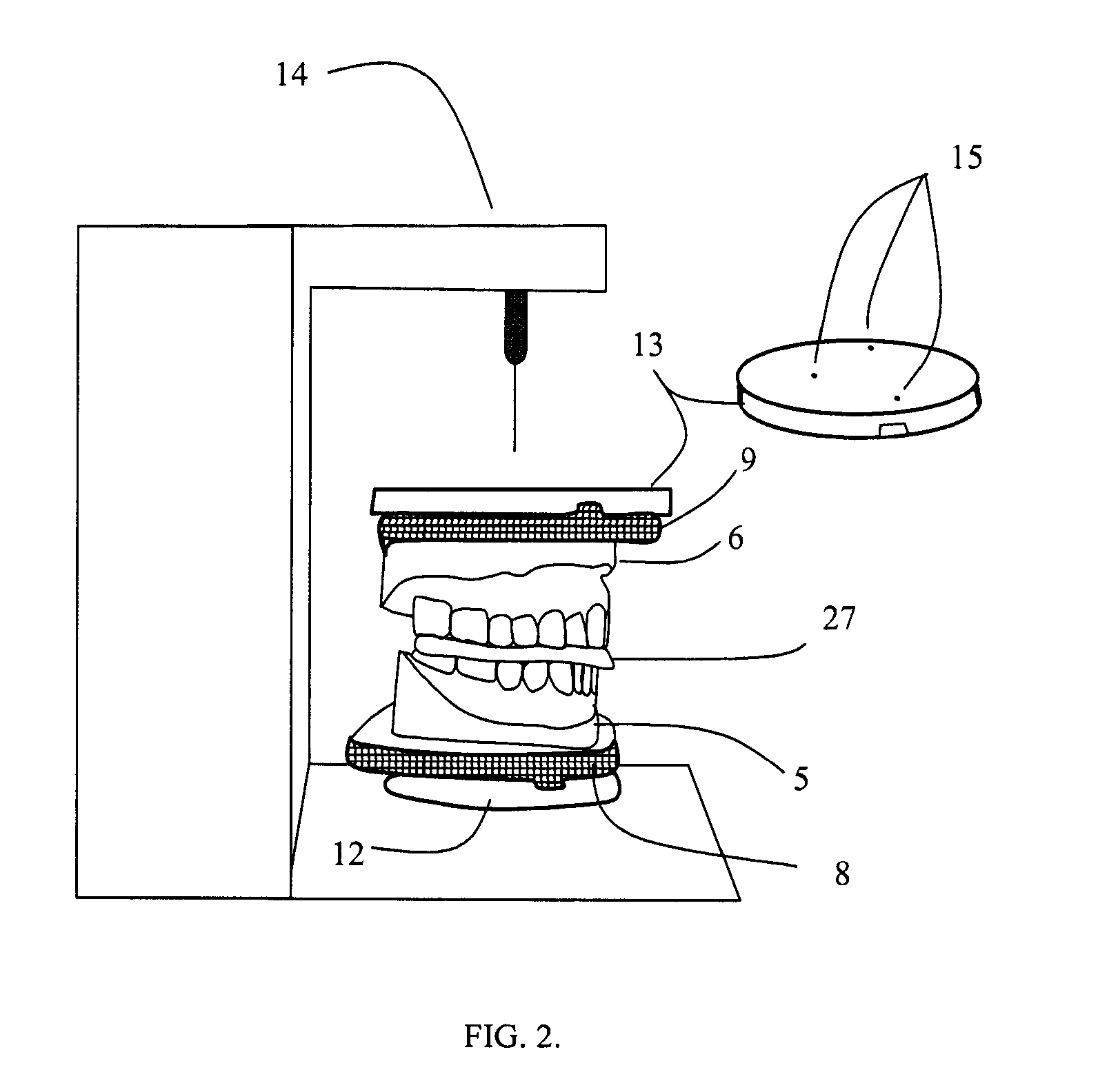 Methods for the virtual design and computer manufacture of intra oral devices