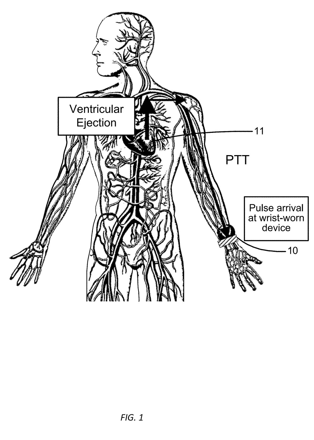 Electrical coupling of pulse transit time (PTT) measurement system to heart for blood pressure measurment