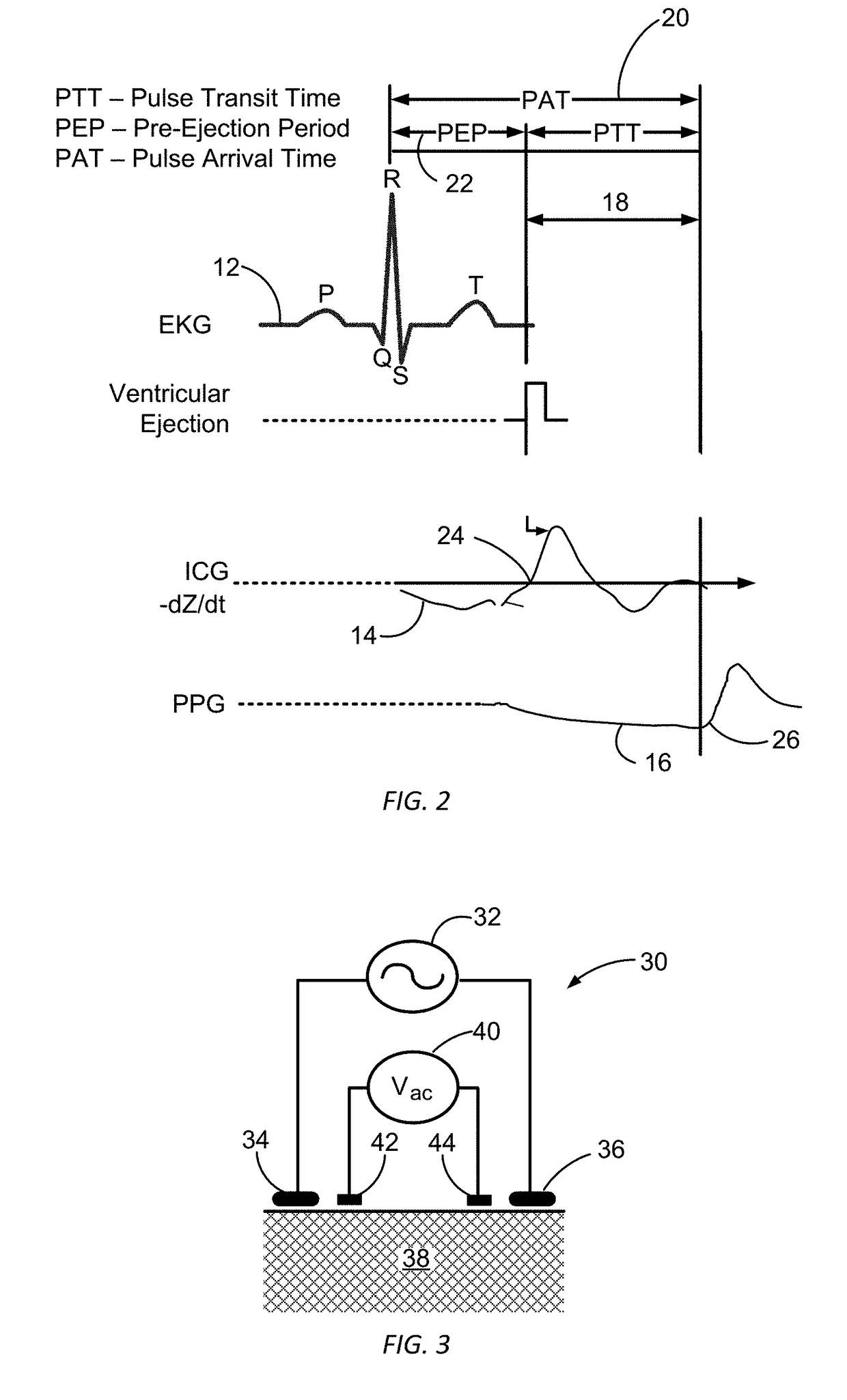 Electrical coupling of pulse transit time (PTT) measurement system to heart for blood pressure measurment